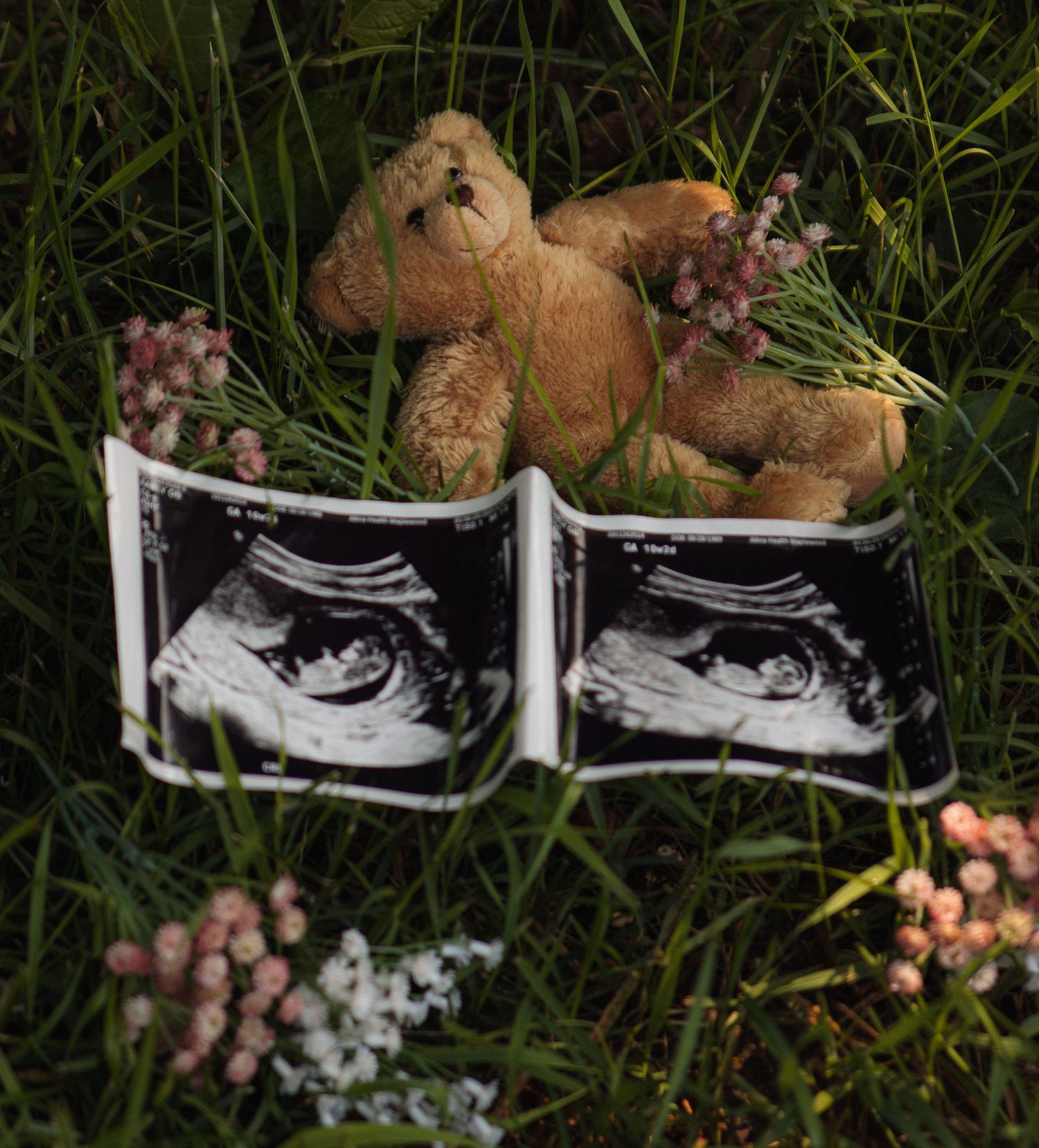 Sonogram photos and teddy bears arranged on grass in a creative pregnancy announcement composition.