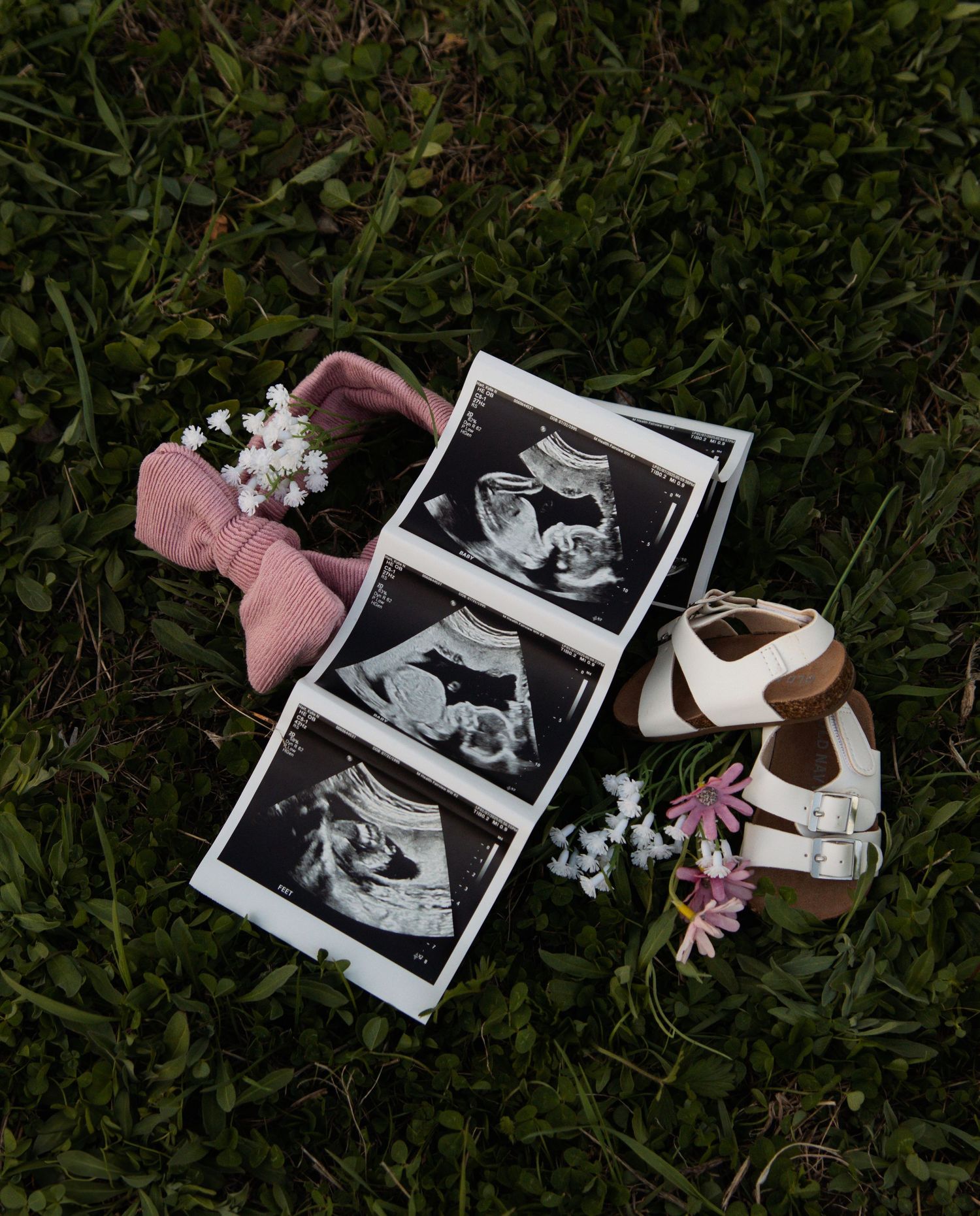 Ultrasound photos displayed on grass with baby shoes, pink bow, and small white flowers in a pregnancy announcement style.