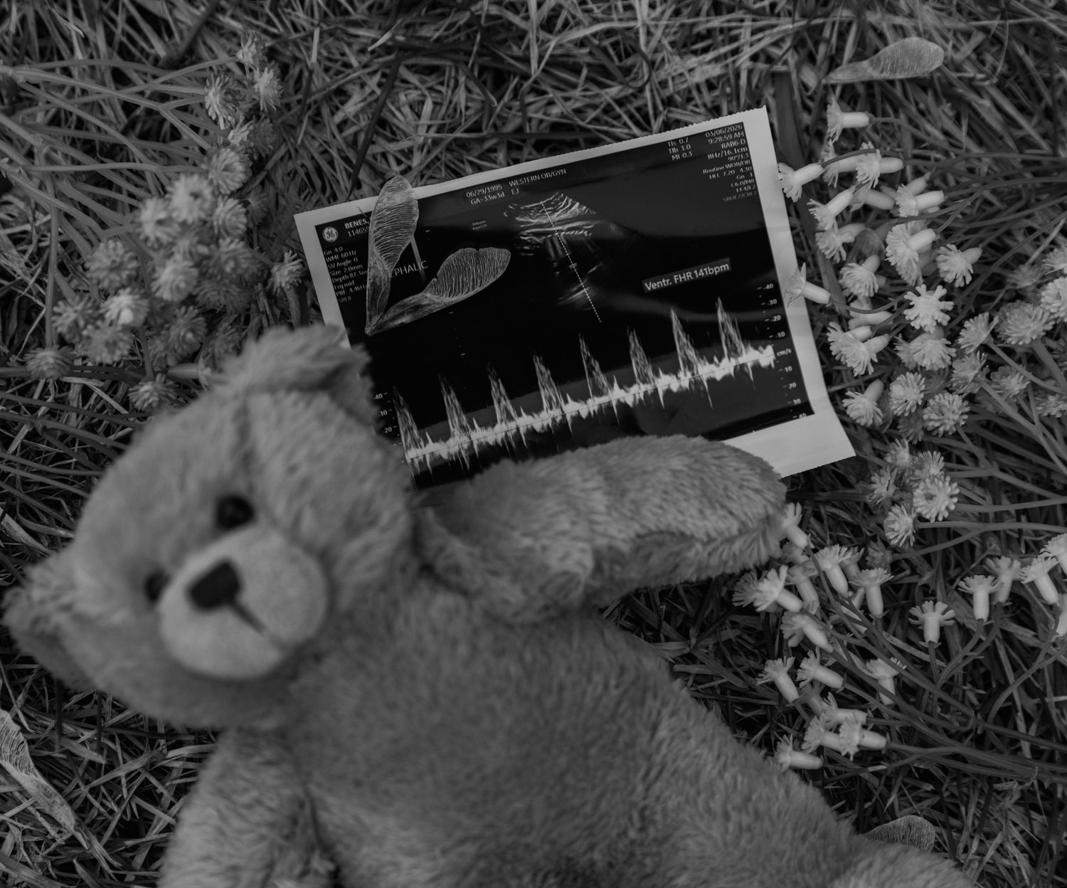 Black and white photo of teddy bear with ultrasound image and wildflowers on grass.