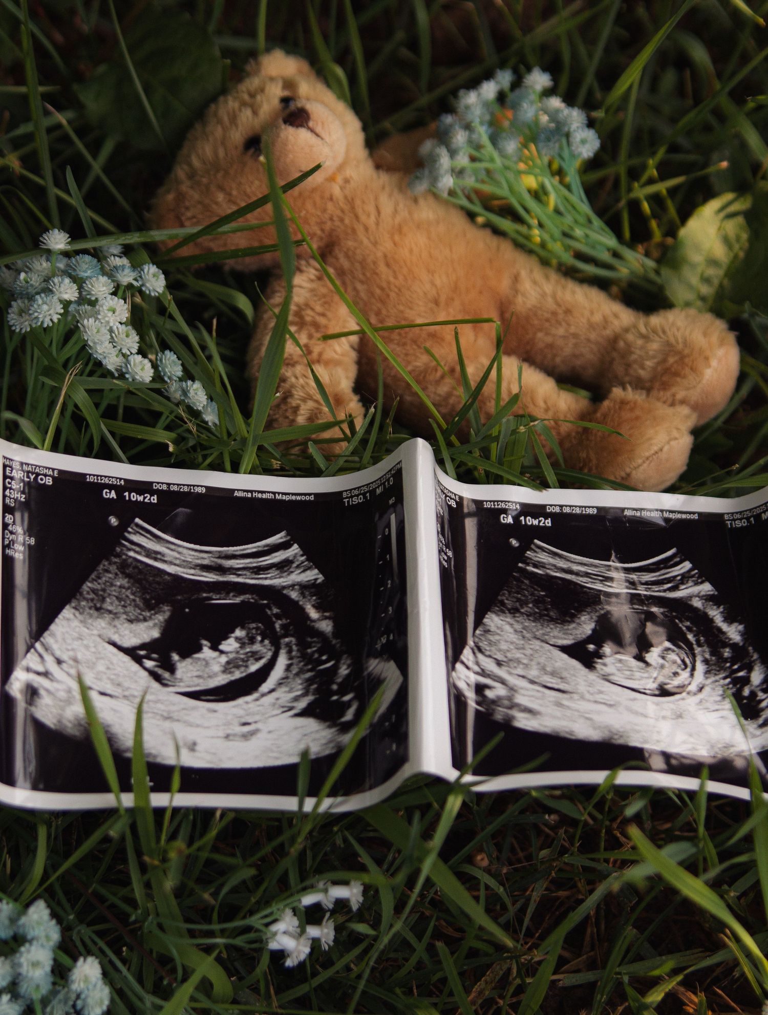 A series of ultrasound images arranged on grass next to a brown teddy bear showing a developing baby in the womb.