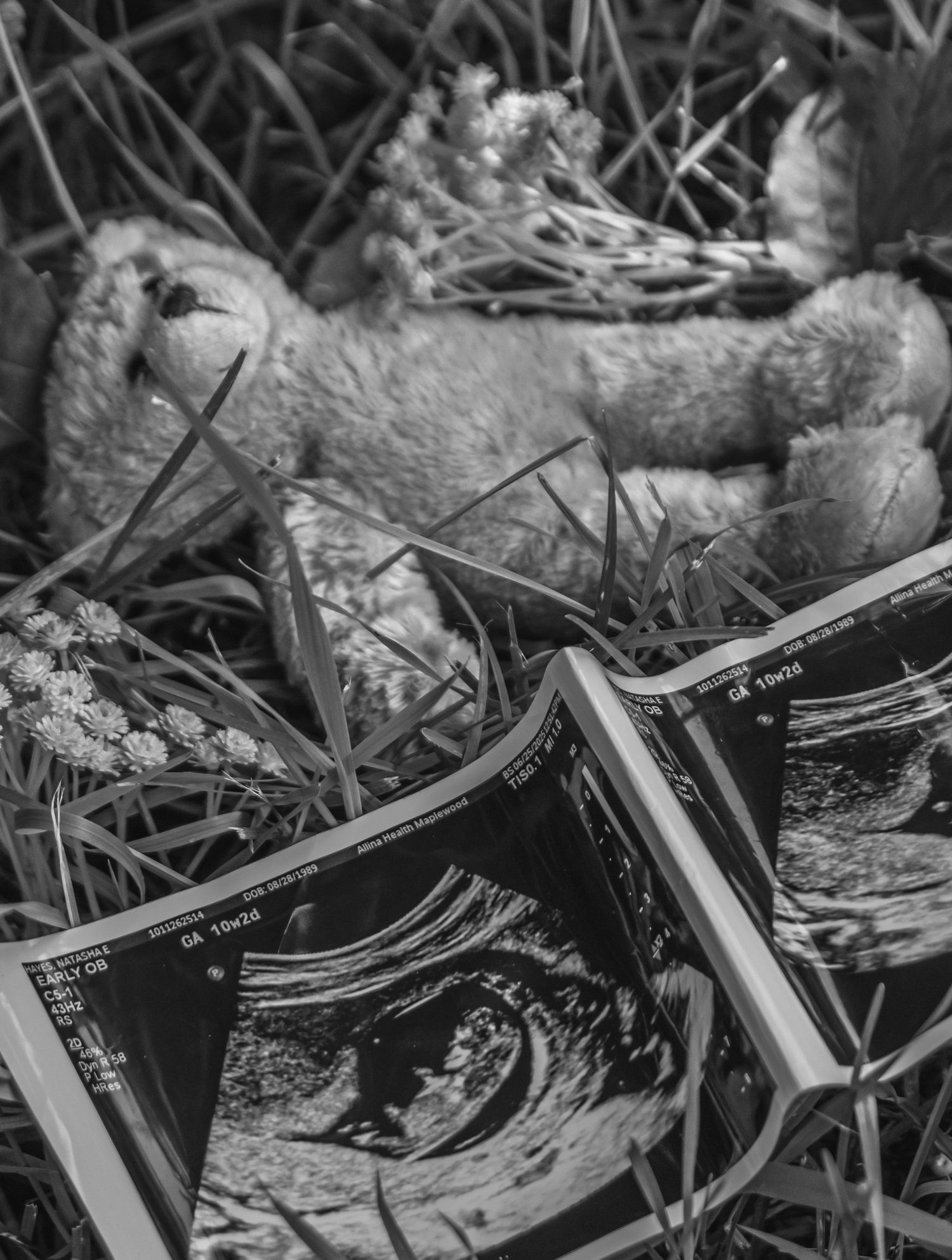 Black and white ultrasound photos laid out in grass with natural lighting.