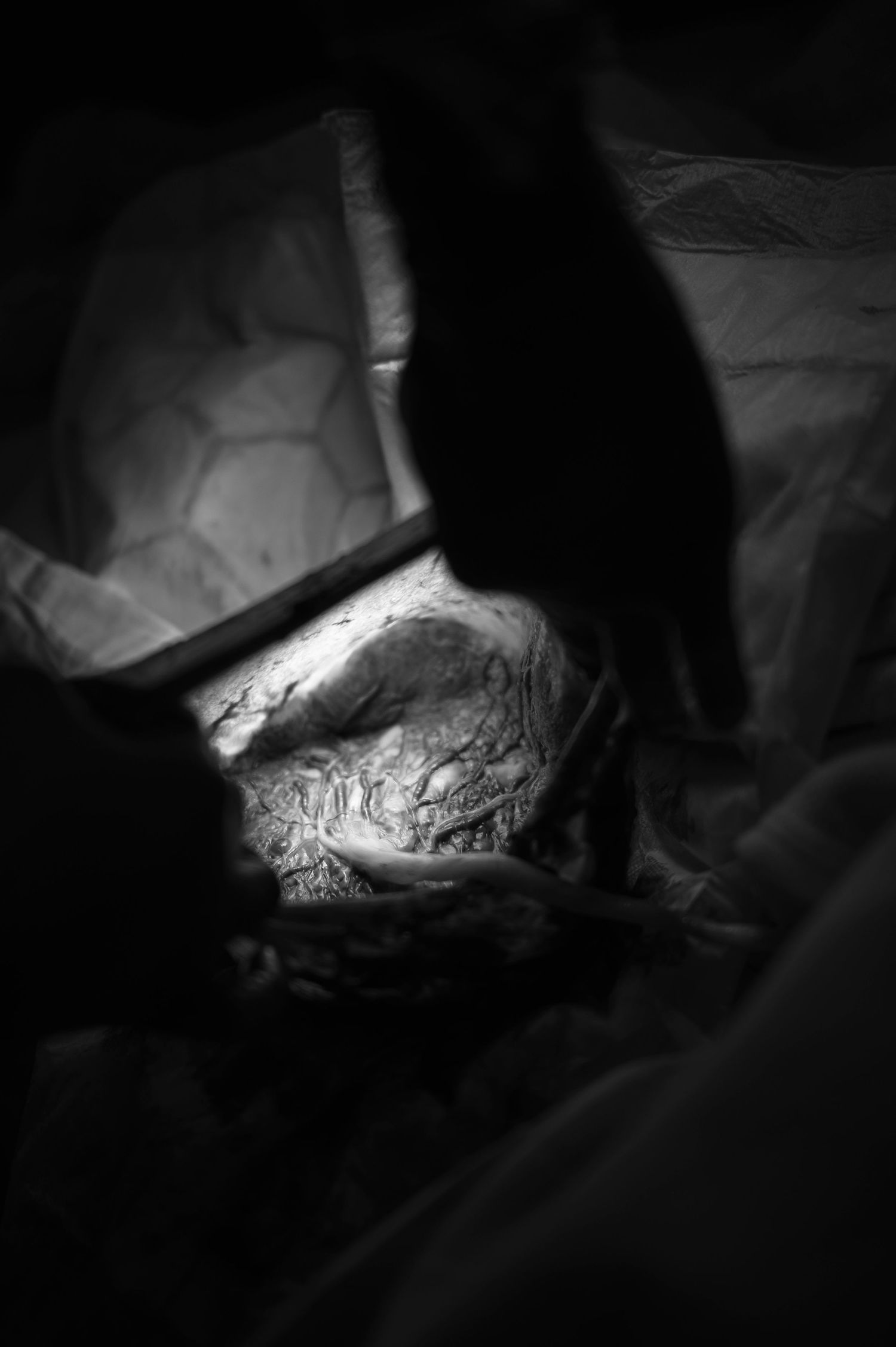 Dramatic black and white close-up of newborn baby's head crowning during birth.
