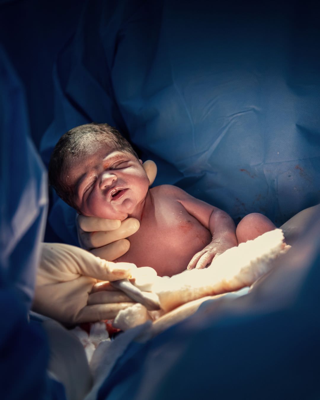 Geburtsfotografie Wiesbaden und Rhein & Main: Neugeborenes wird gerade behutsam aus dem Bauch der Mutter geholt, ein emotionaler Moment
