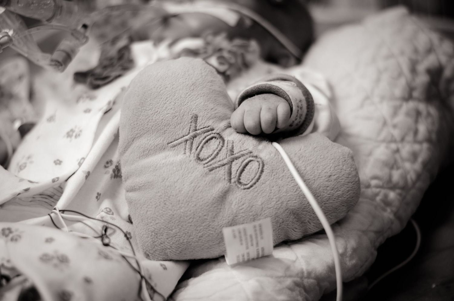 Newborn baby sleeping peacefully in hospital bassinet with medical equipment and monitors.