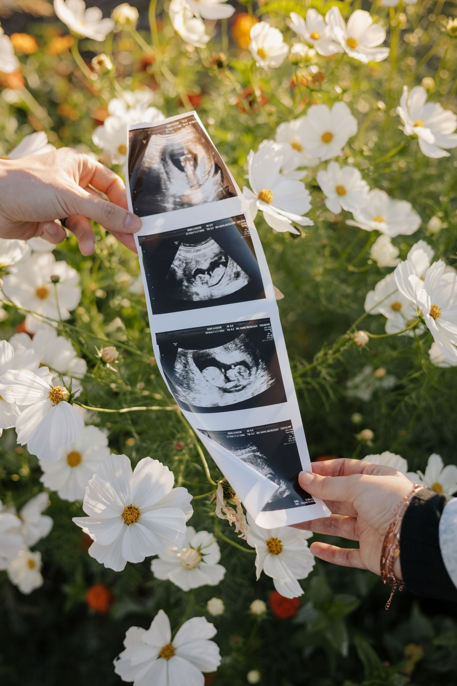 Hands holding ultrasound photos against a backdrop of blooming white cosmos flowers in a garden setting.