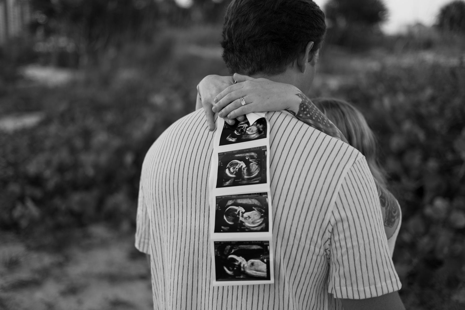 Black and white photo of couple embracing with ultrasound strip displayed on partners back.