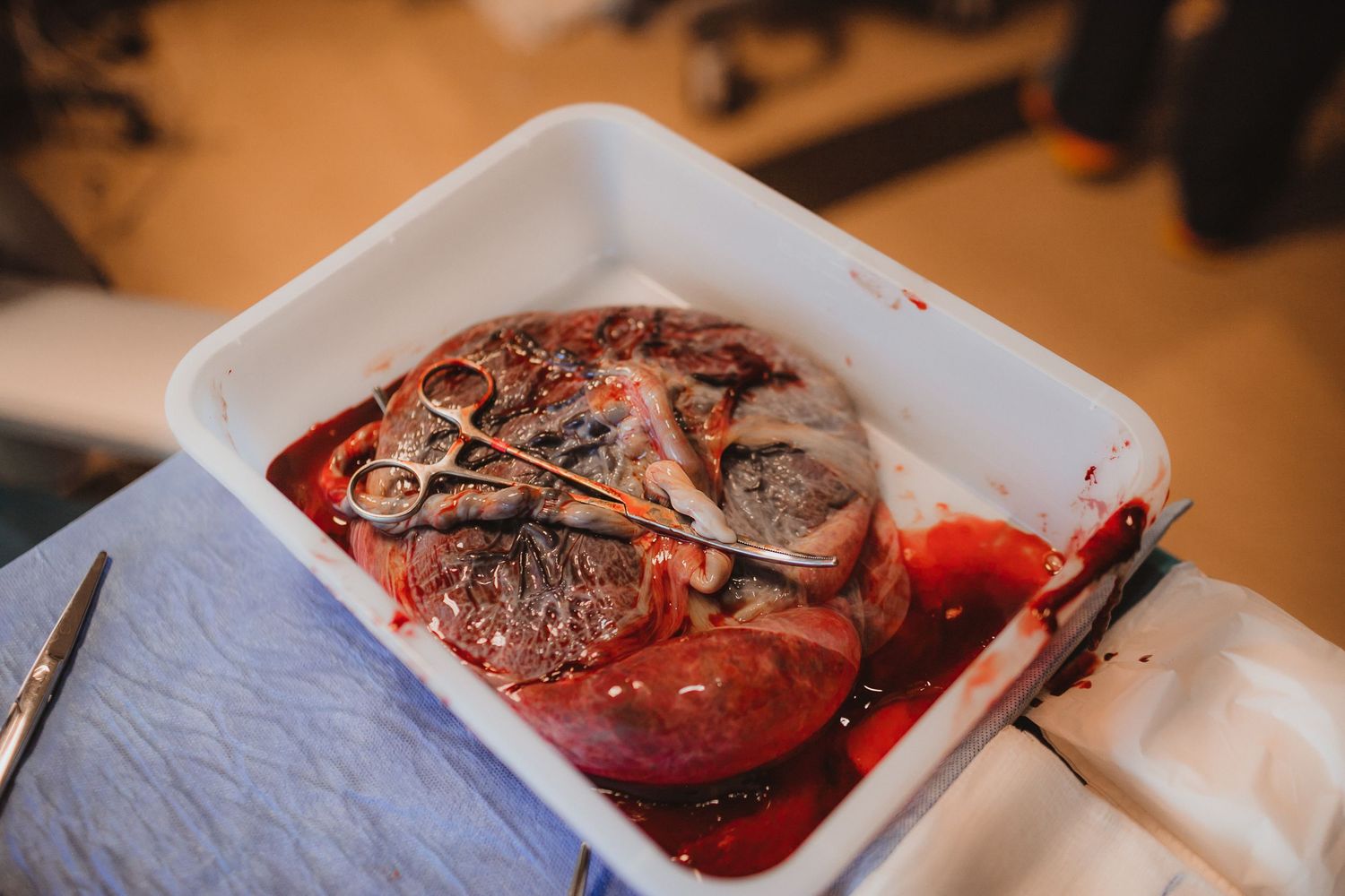 placenta encapsulation salina kansas