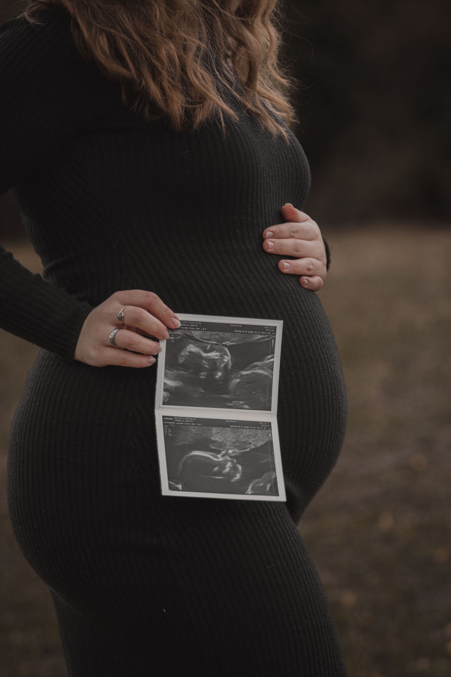 kismama fekete ruhában ultrahang képeket tart, miközben a pocakját simogatja