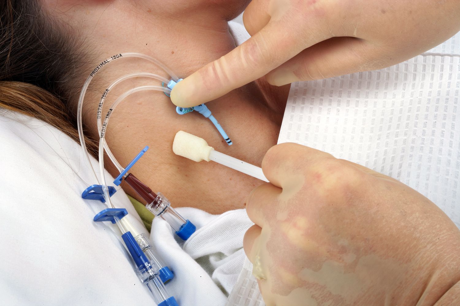 Close-up view of hands performing medical procedure with blue surgical tools and white gauze material.