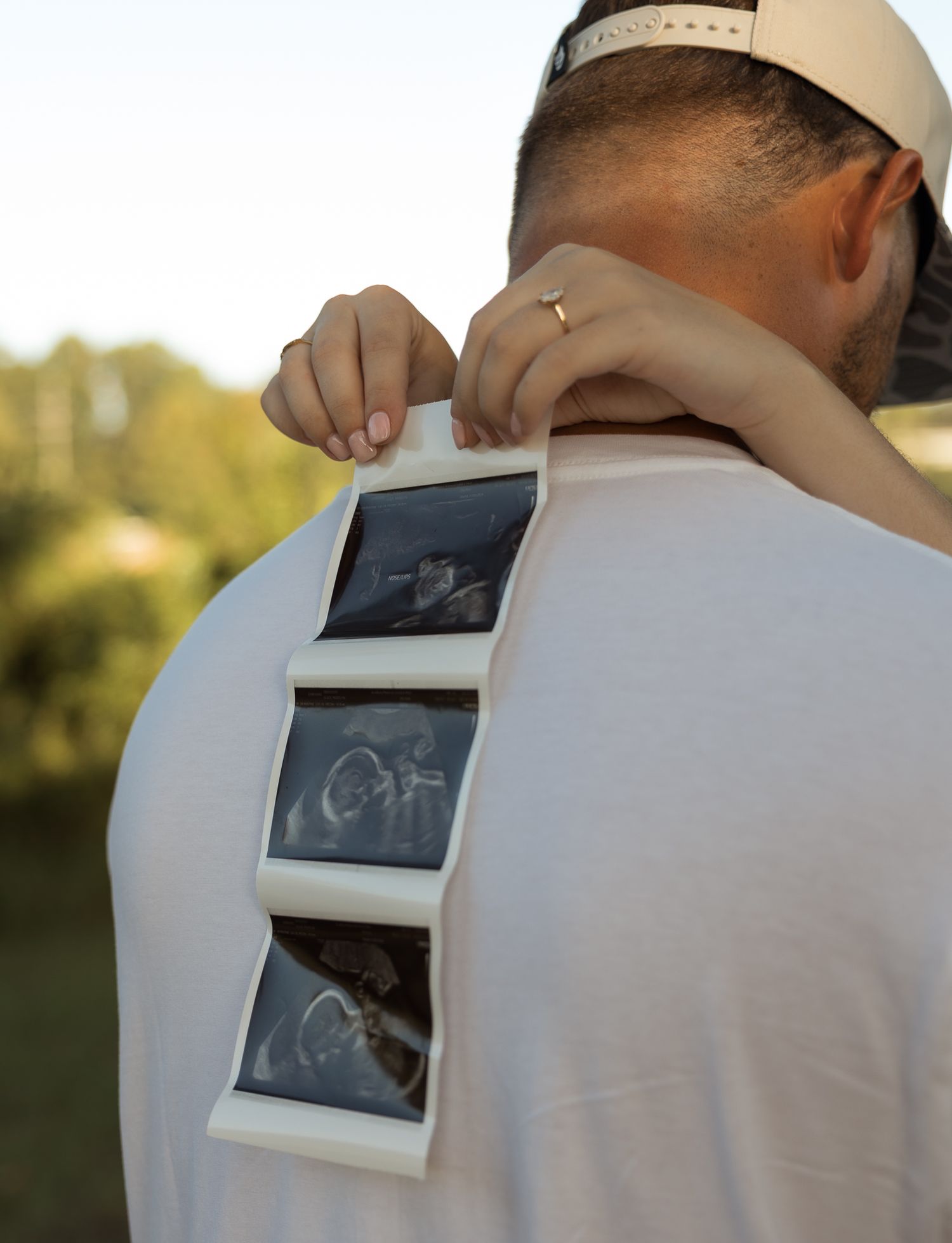 Person holding ultrasound photos against their back wearing white shirt, pregnancy announcement photo outdoors.