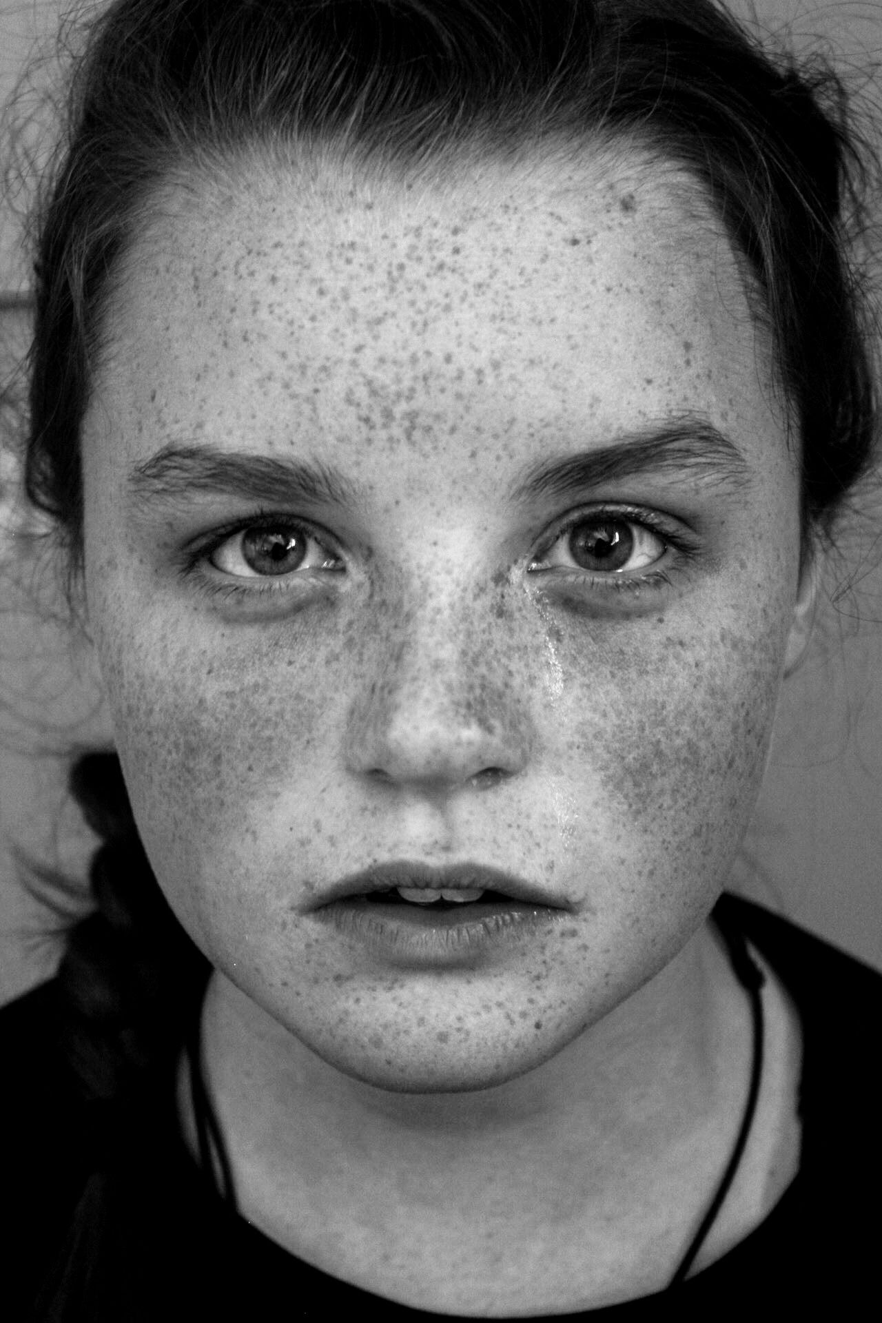 Black and white close-up portrait of a young girl with freckles and an intense gaze.