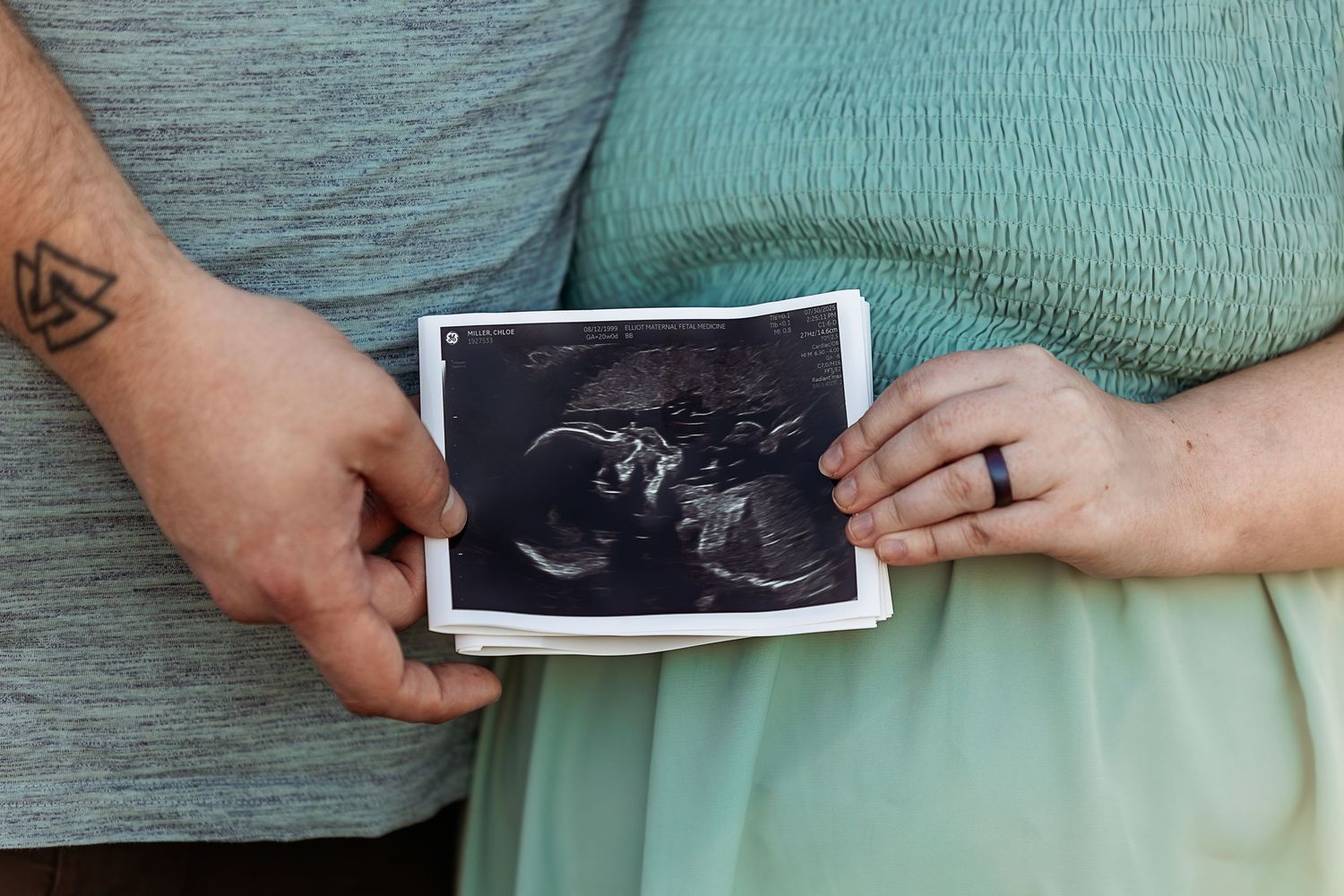 A series of hands holding ultrasound images showing different stages of fetal development during pregnancy.