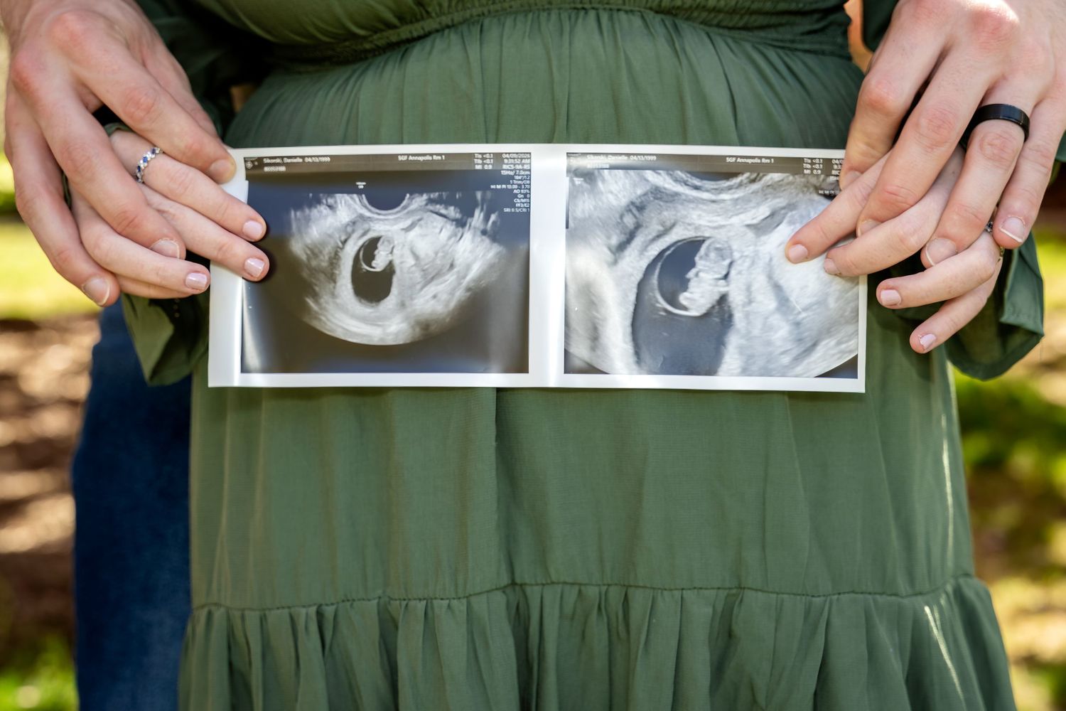 Pregnant woman in green dress holding two ultrasound photos showing twins against an outdoor background.