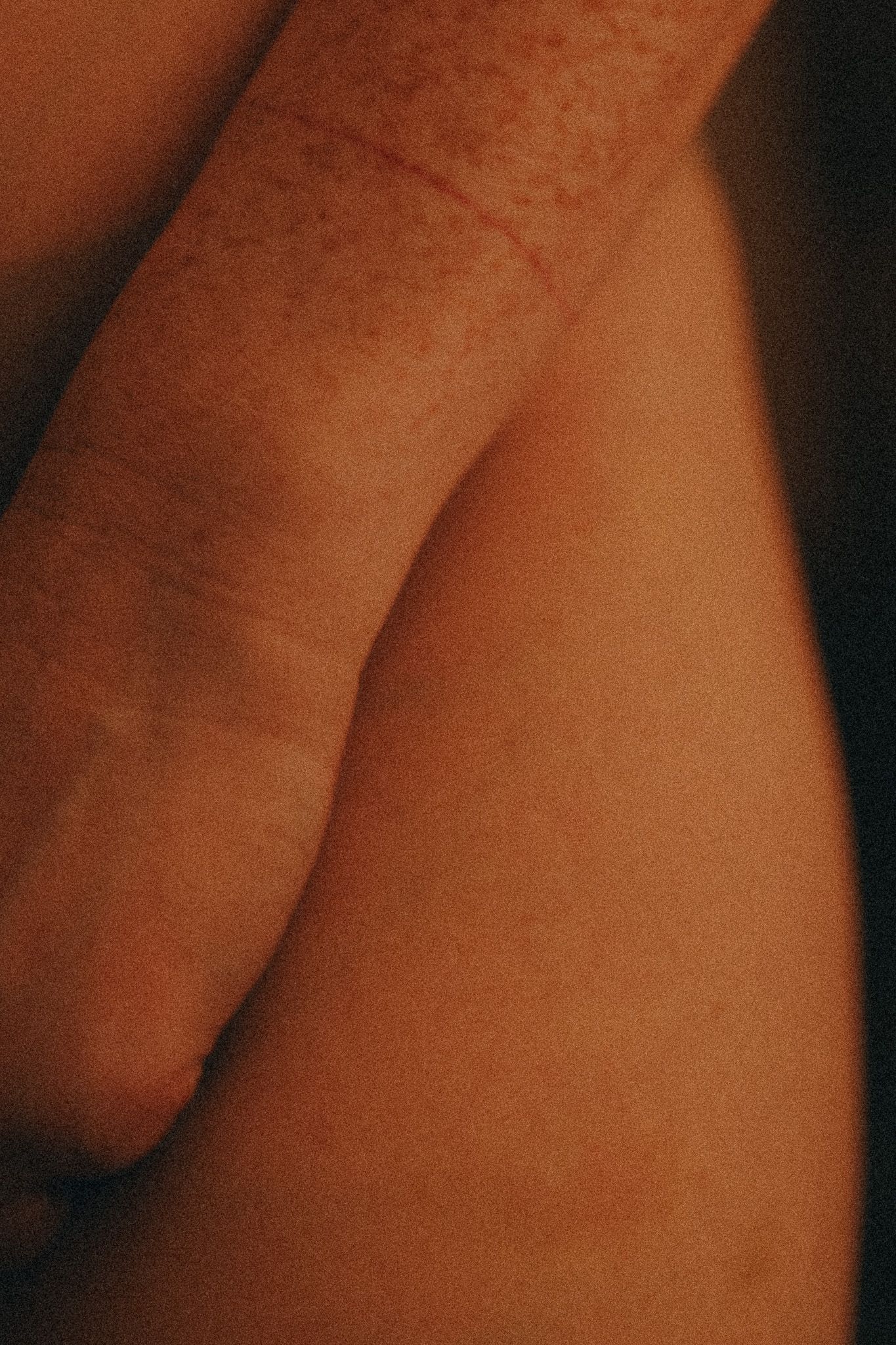 Soft focus close-up of skin texture in warm ambient lighting.