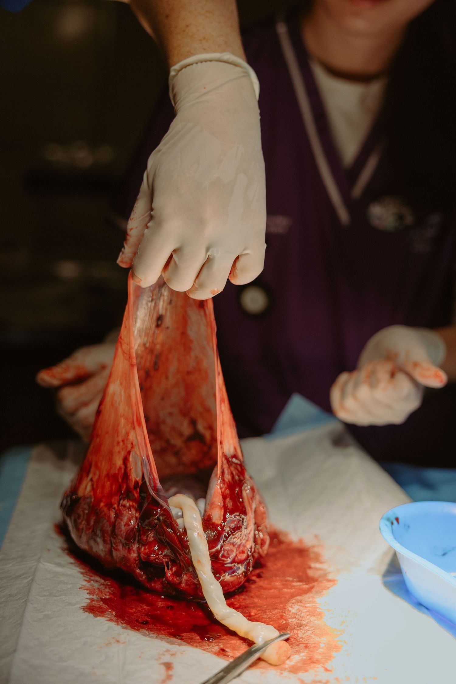 Midwife lifting placenta
Midwife lifting placenta during raw, documentary-style birth photography in Brisbane.