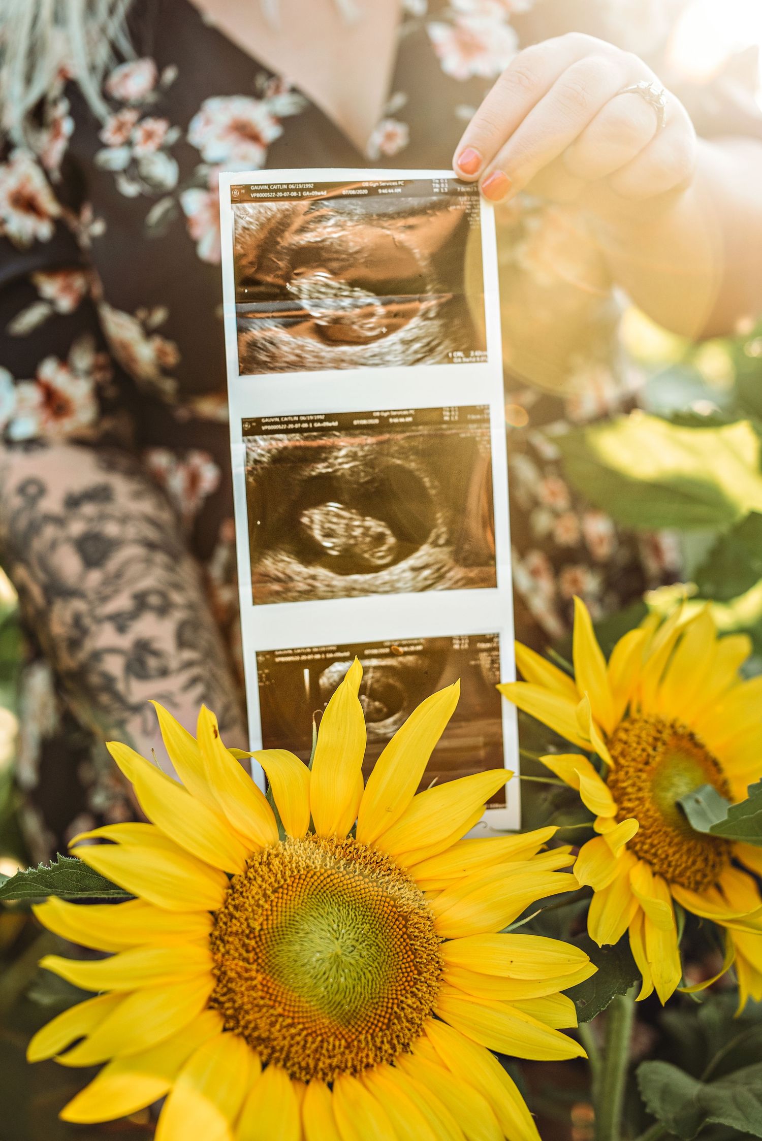Pregnant woman holding ultrasound photos surrounded by bright yellow sunflowers in warm sunlight.