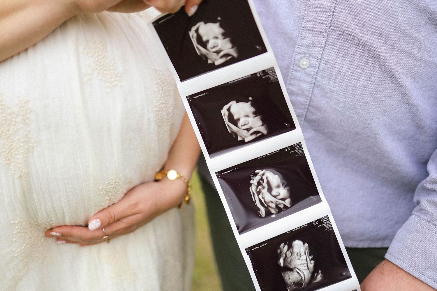 Collection of ultrasound photos displayed with hands gently holding them.