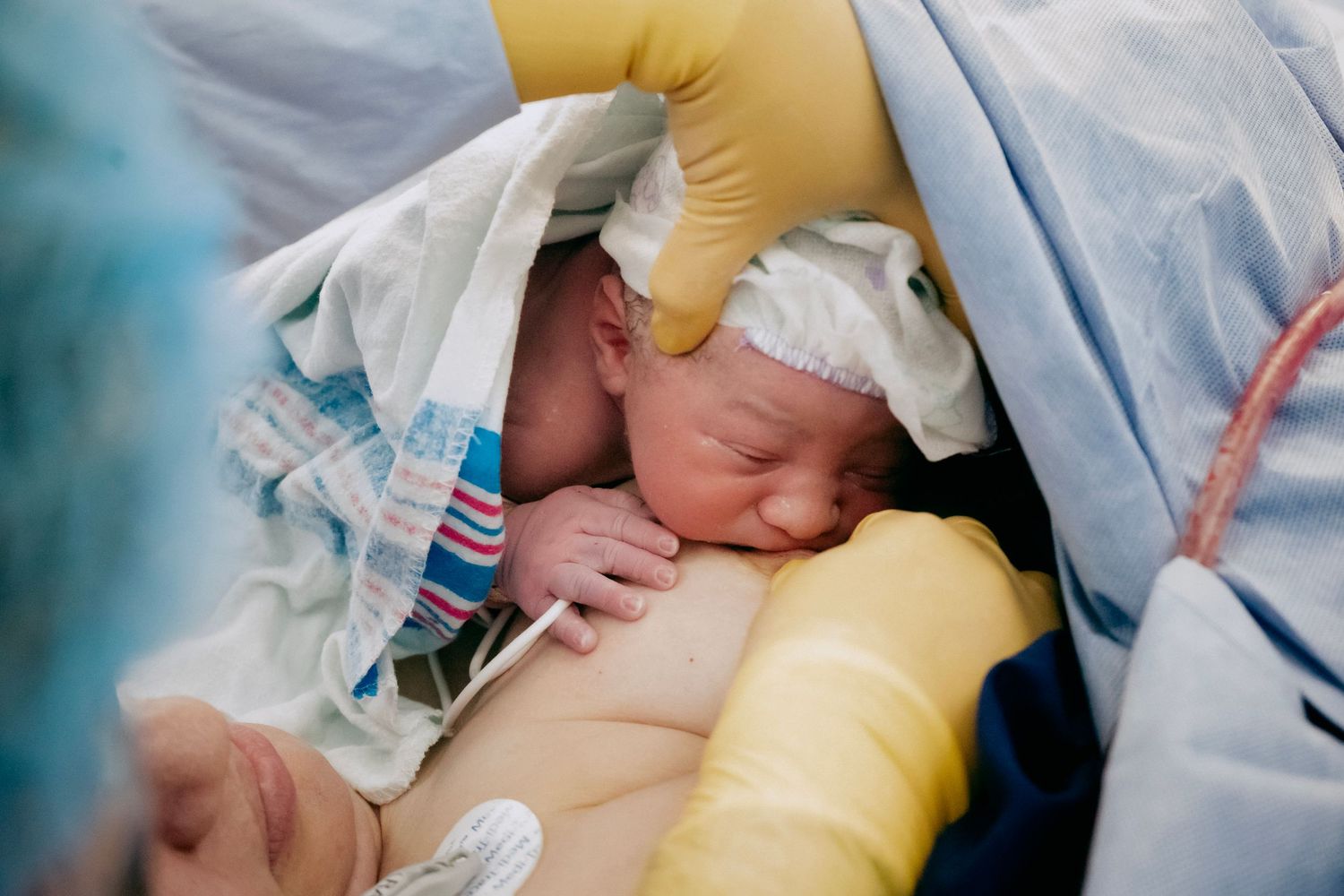 Cesárea en Hospital Metropolitano Lindora, San José, Costa Rica – fotografía de nacimiento por Dianne García