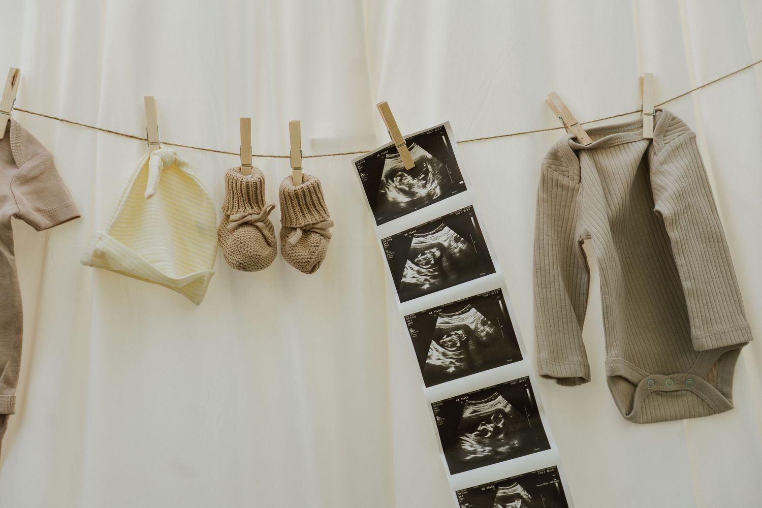 Decorative clothesline displaying ultrasound photos and baby items against white backdrop.
