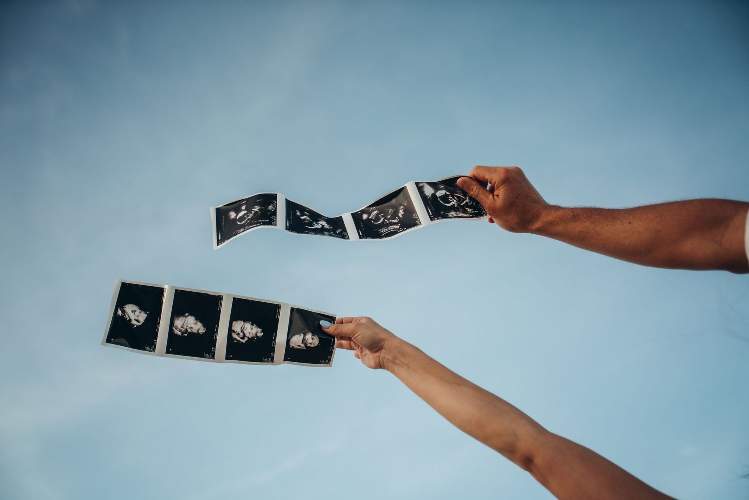 Two hands holding strips of ultrasound photos against a clear blue sky.