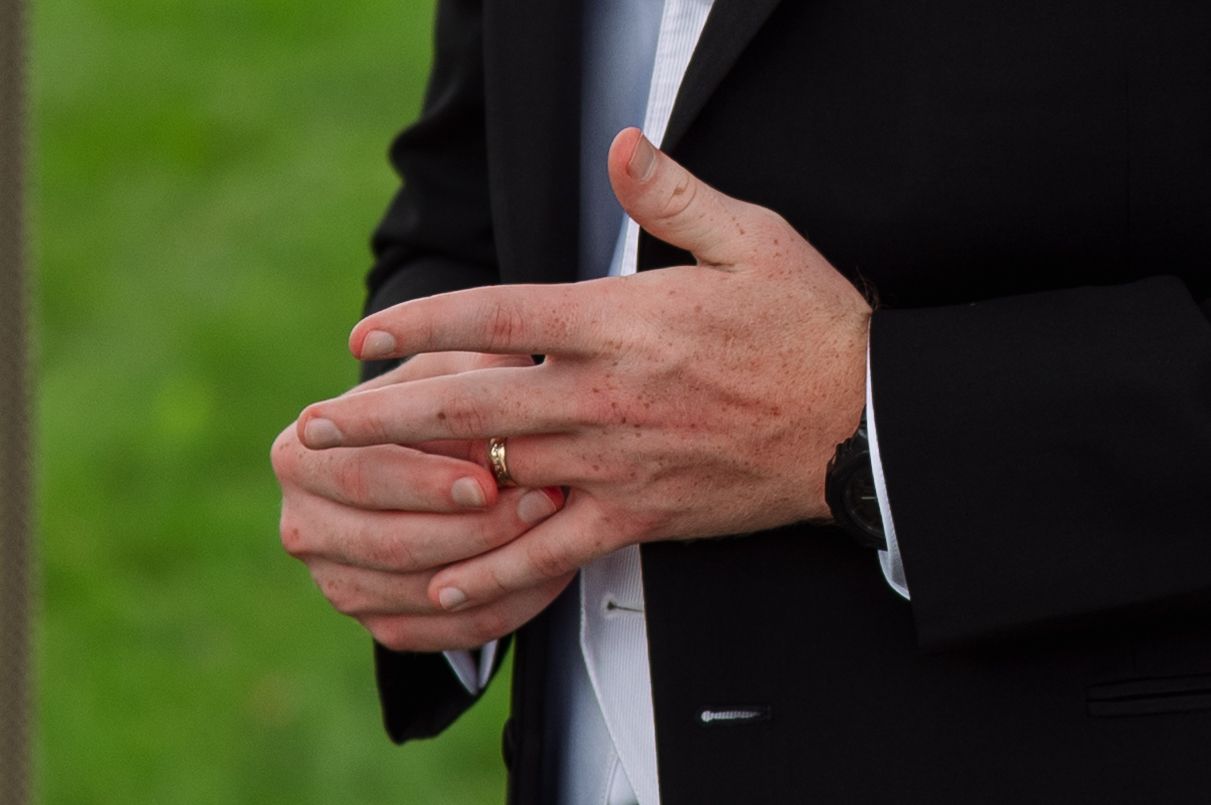 Close-up of a groom in a black suit and white shirt adjusting his wedding ring, with a blurred green lawn in the background.