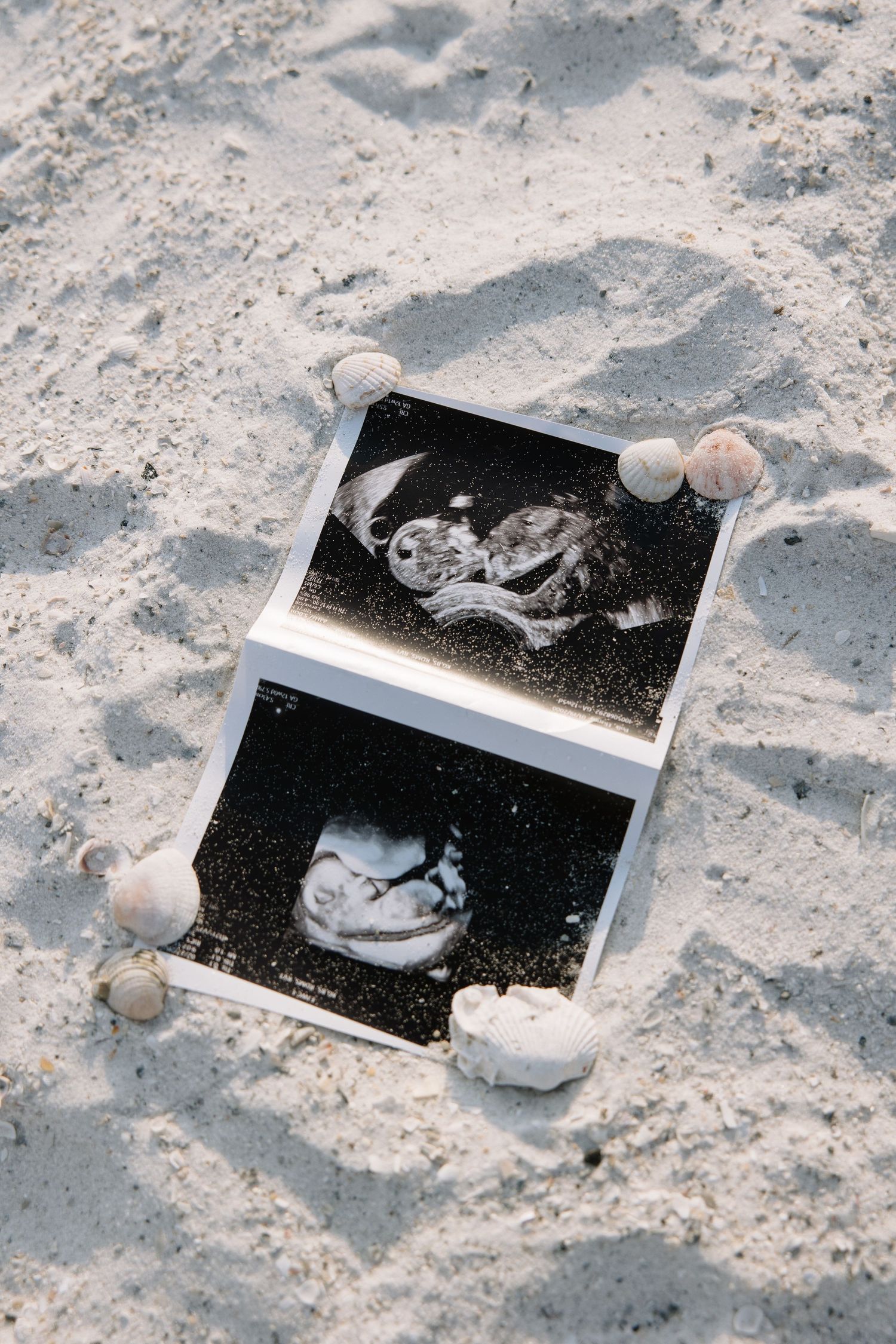 Sonogram photo is placed in the sand with seashells for maternity photos captured by Michaela Gom Photography.