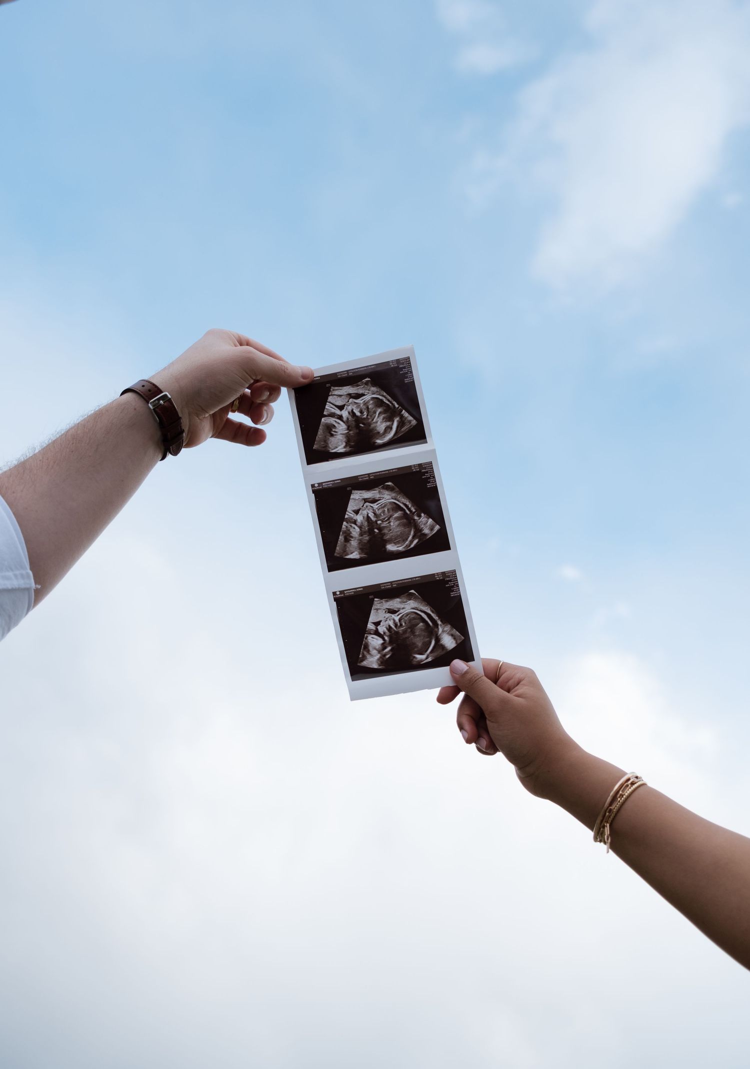 Two hands holding ultrasound sonogram photos up against a blue sky, announcing pregnancy.