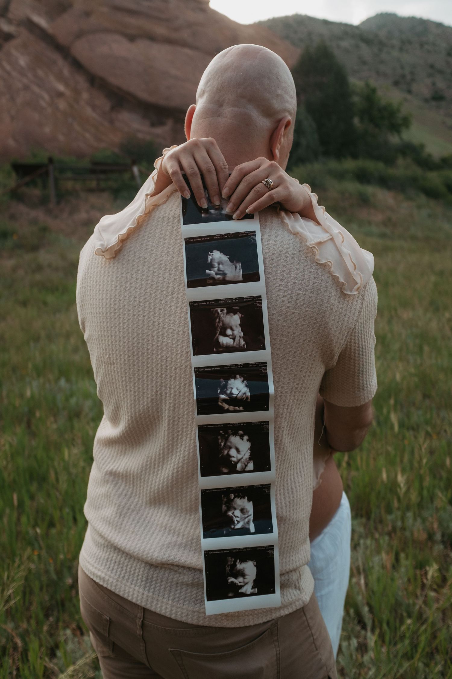 Someone displays a strip of ultrasound photos on their back against a cream sweater in an outdoor setting.