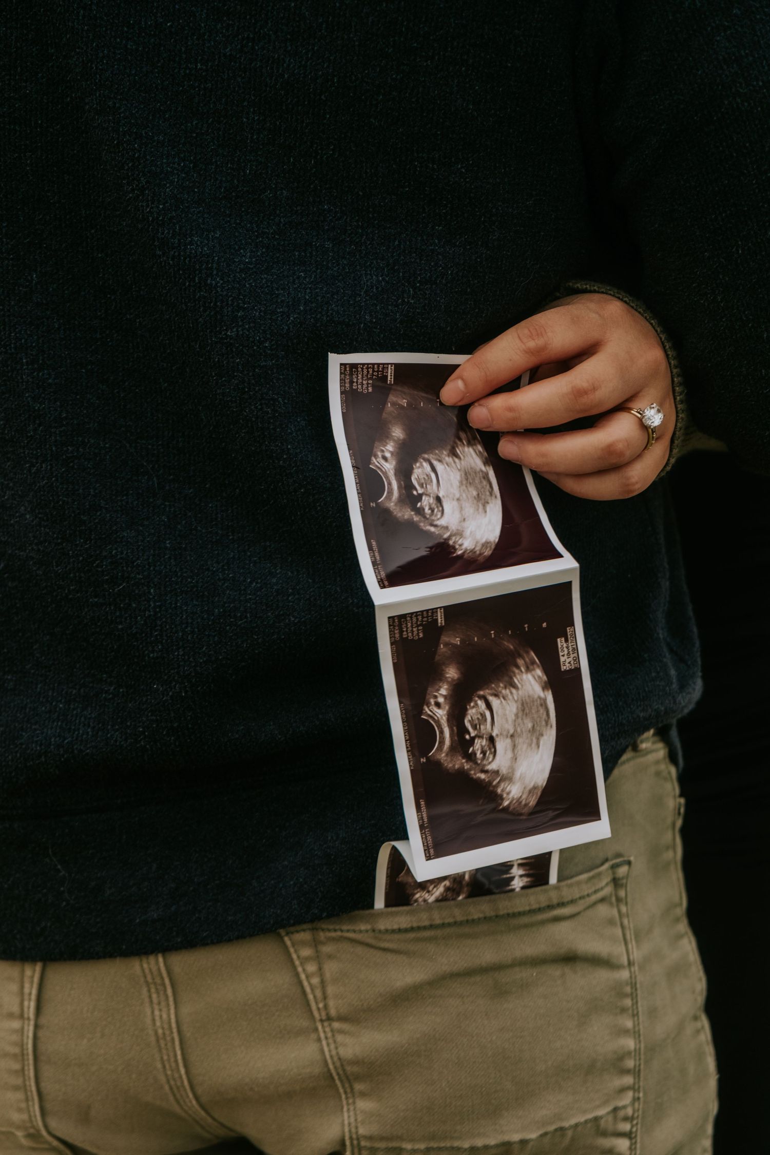 Hands holding ultrasound photos against dark background.