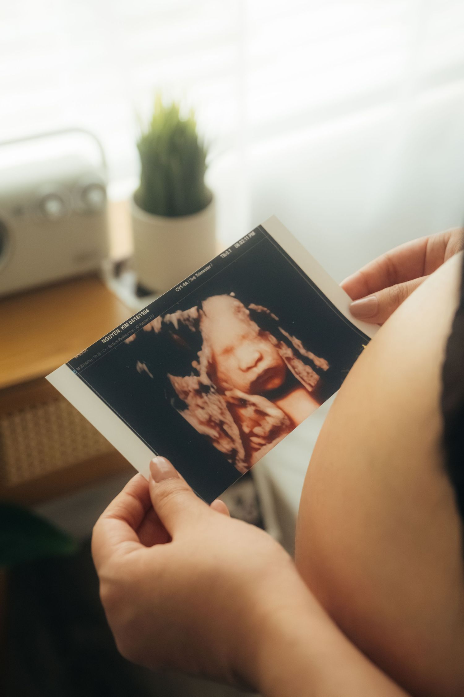 Hands holding ultrasound photos in a bright, modern room setting.