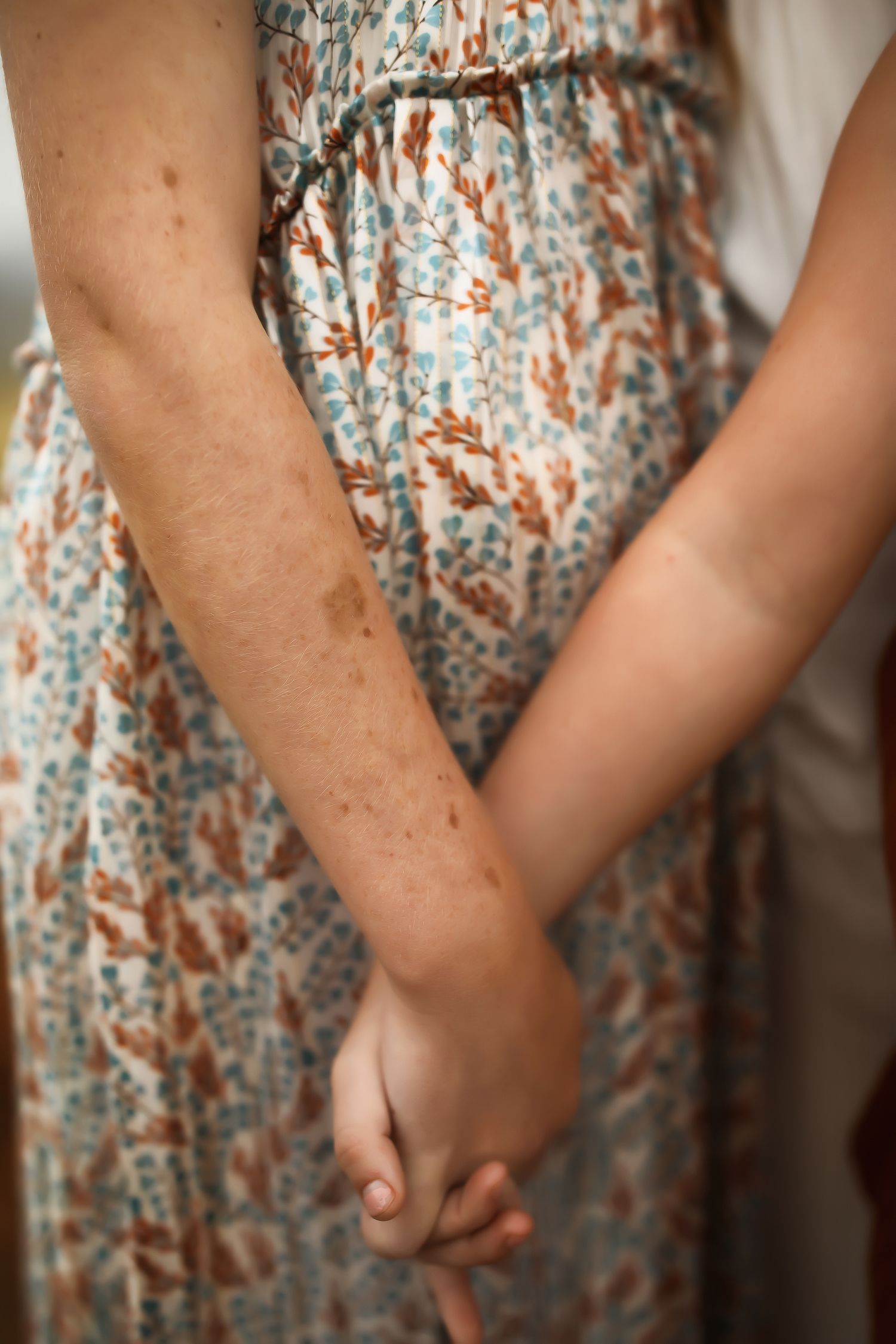 Detail shots of hands and arms against a floral print dress pattern.