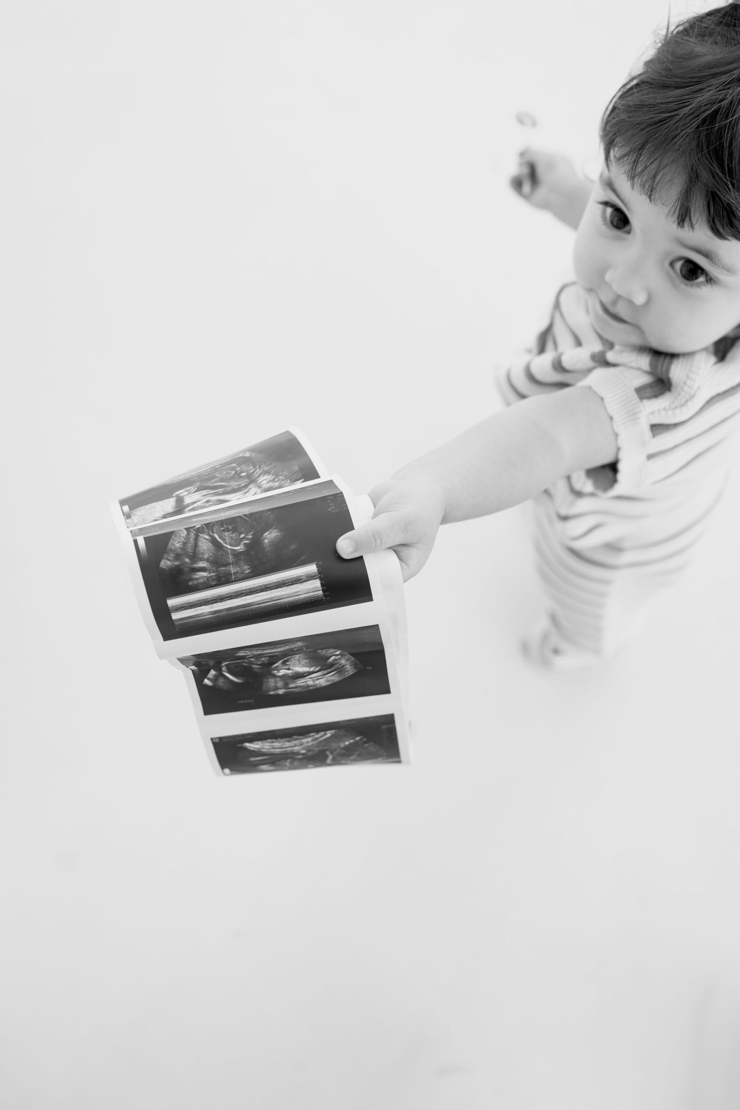 Black and white studio photo showing ultrasound images against white background.