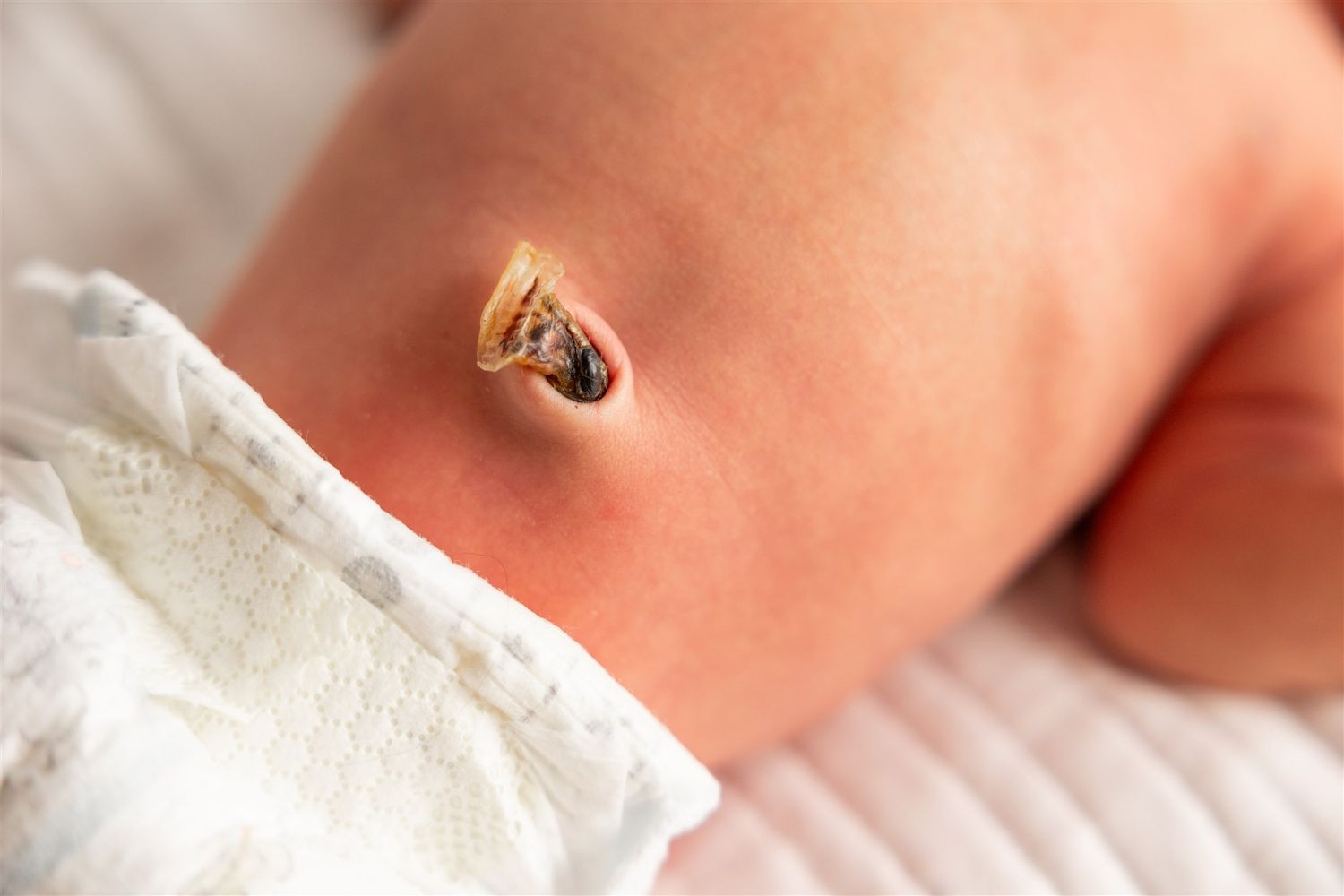 fresh 48 session showing babies umbilical stump