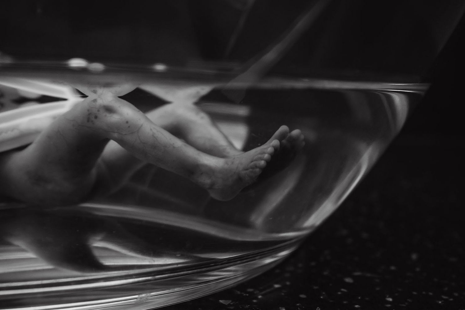 water immersion bereavement photos of newborn baby 17 weeks gestation