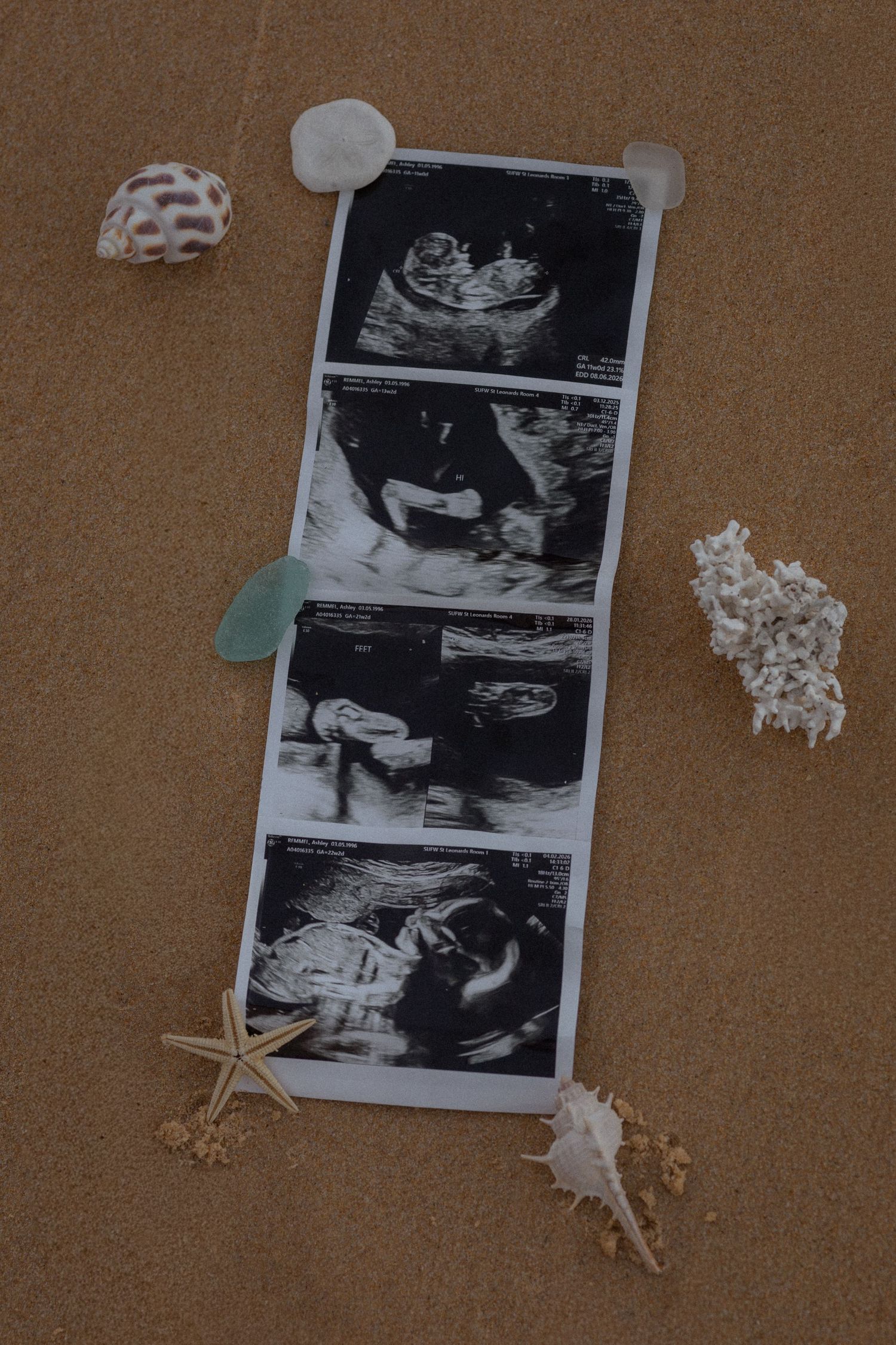 Ultrasound photos strip displayed on sandy beach surrounded by seashells, starfish, and sea glass.