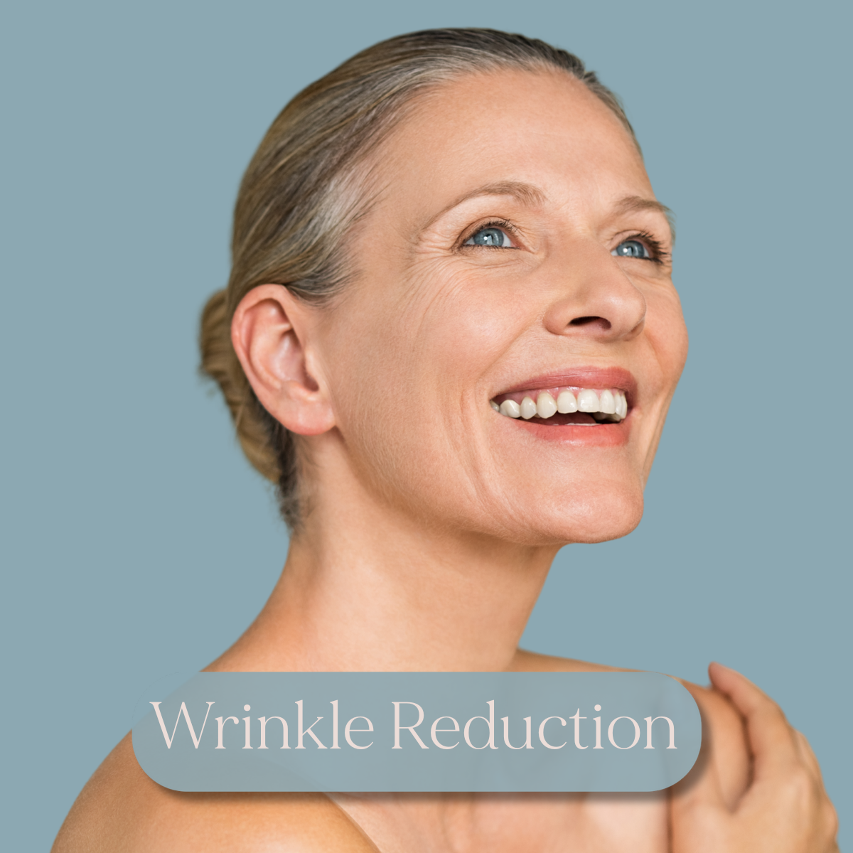 Elegant mature woman smiling highlighting wrinkle reduction treatment.