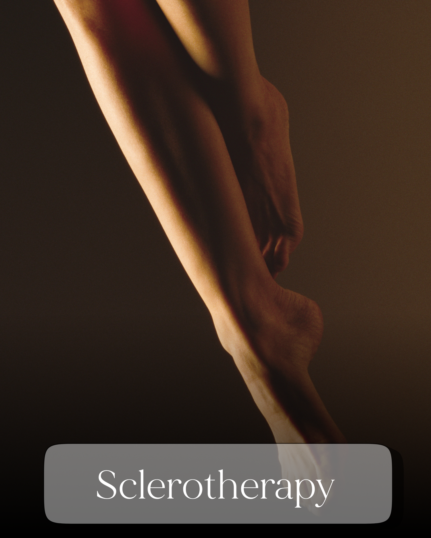 Artistic photo of toned legs representing sclerotherapy treatment for spider and varicose veins.