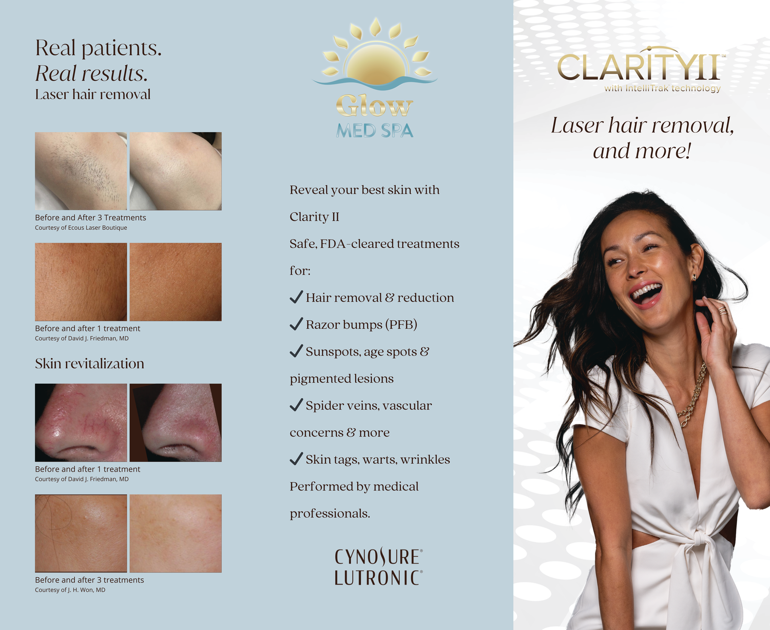 Glow Med Spa ClarityII laser hair removal brochure showing real patient results and treatment options.