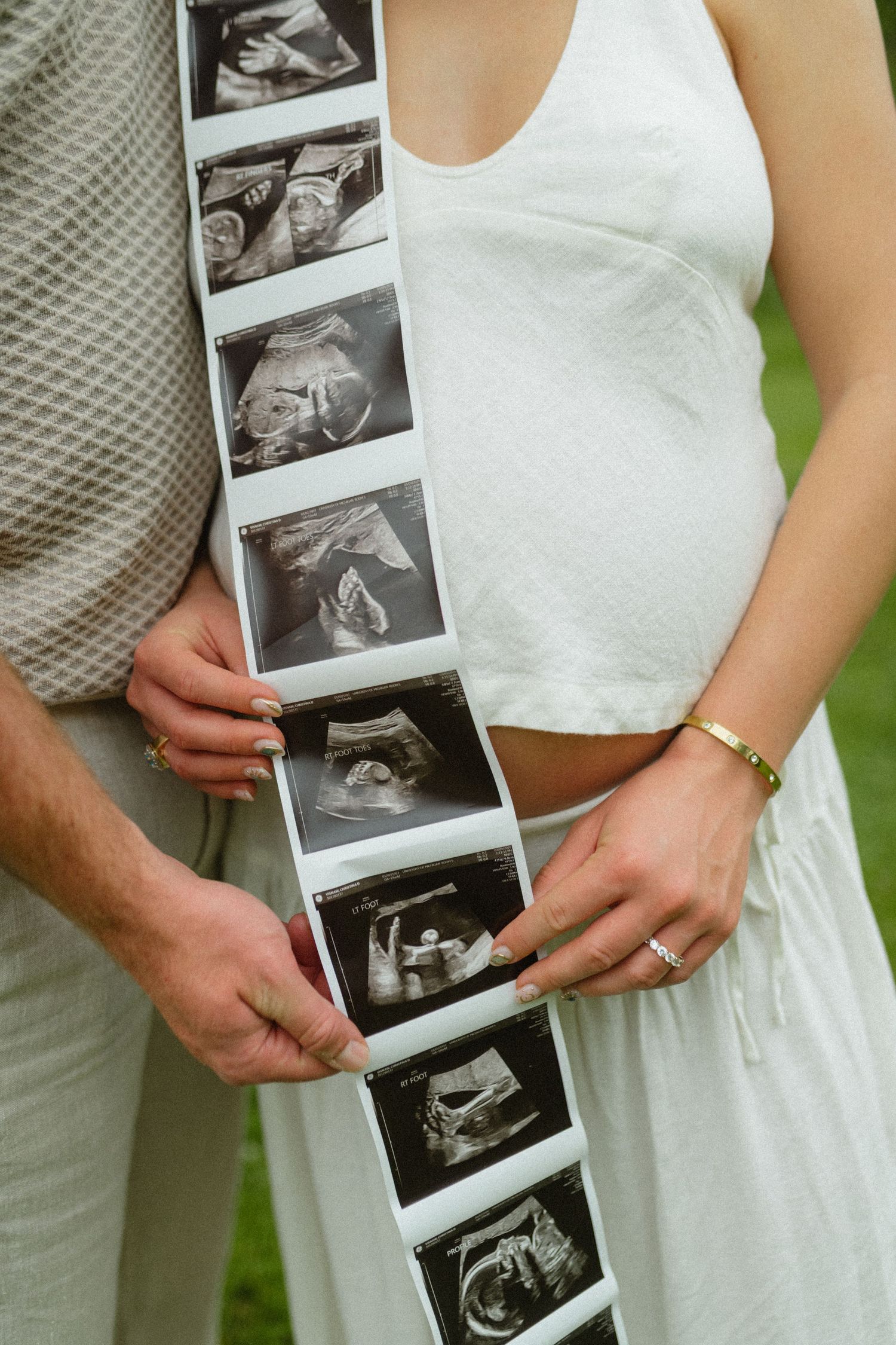 Couple holding ultrasound strip photos showing baby scans during pregnancy outdoors.