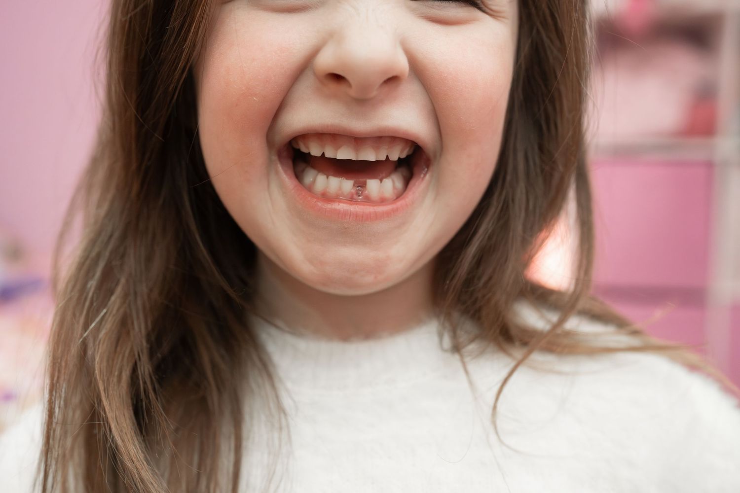 Young girl laughing with missing front tooth, showing natural childhood milestone of losing baby teeth.