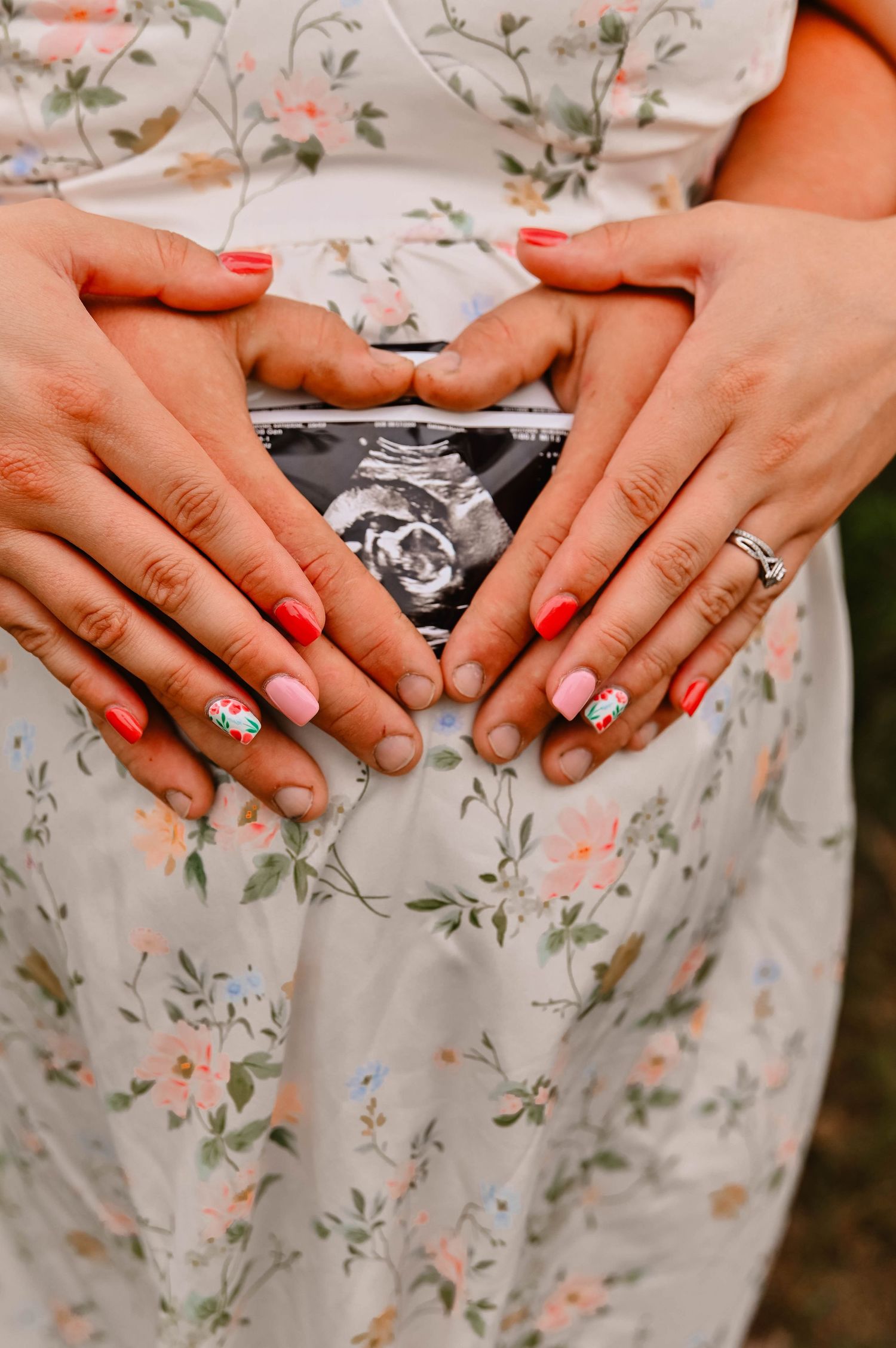 Hands displaying ultrasound photo and engagement ring against floral dress fabric.