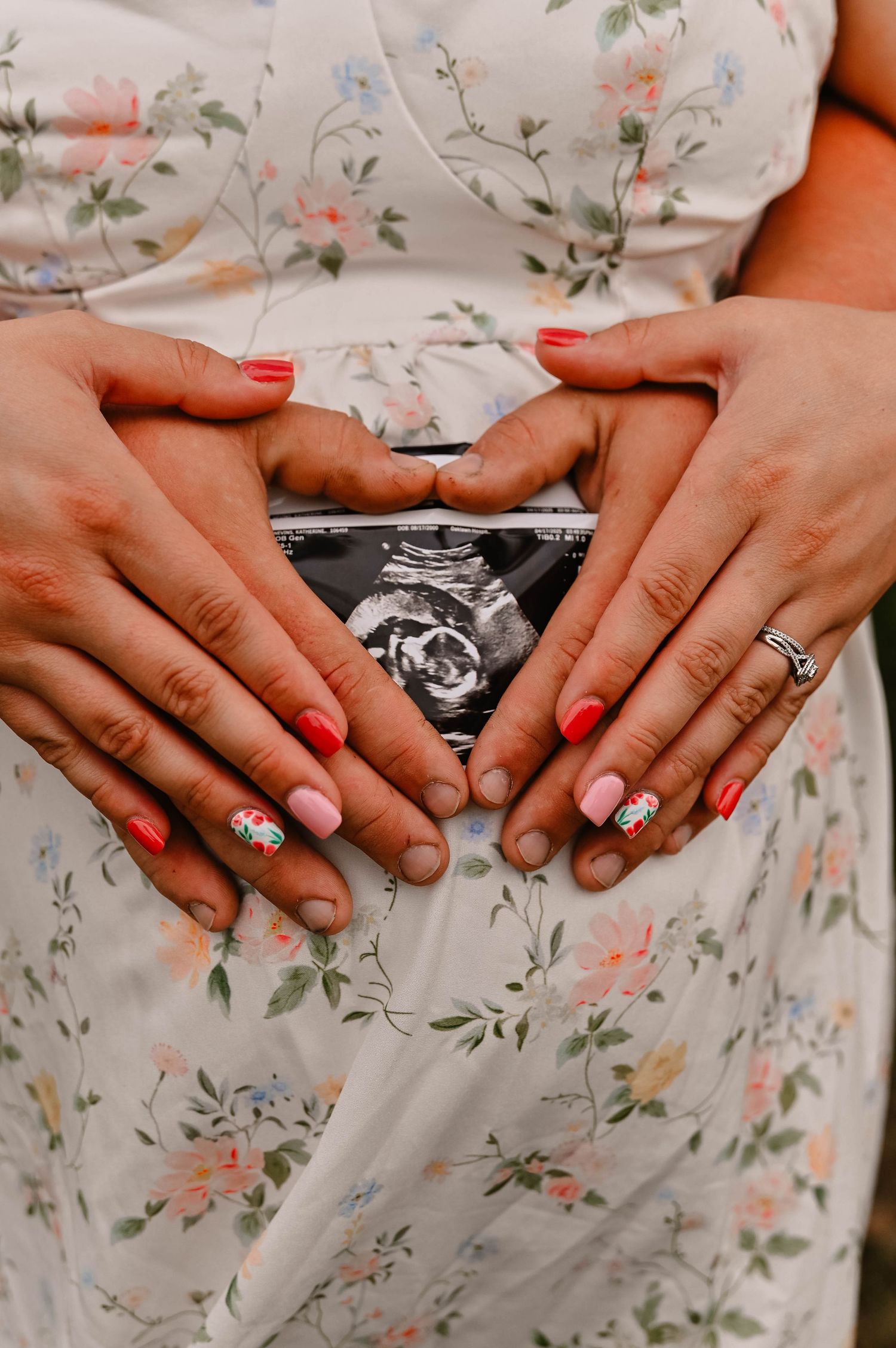 Hands holding ultrasound photos against a floral dress background.