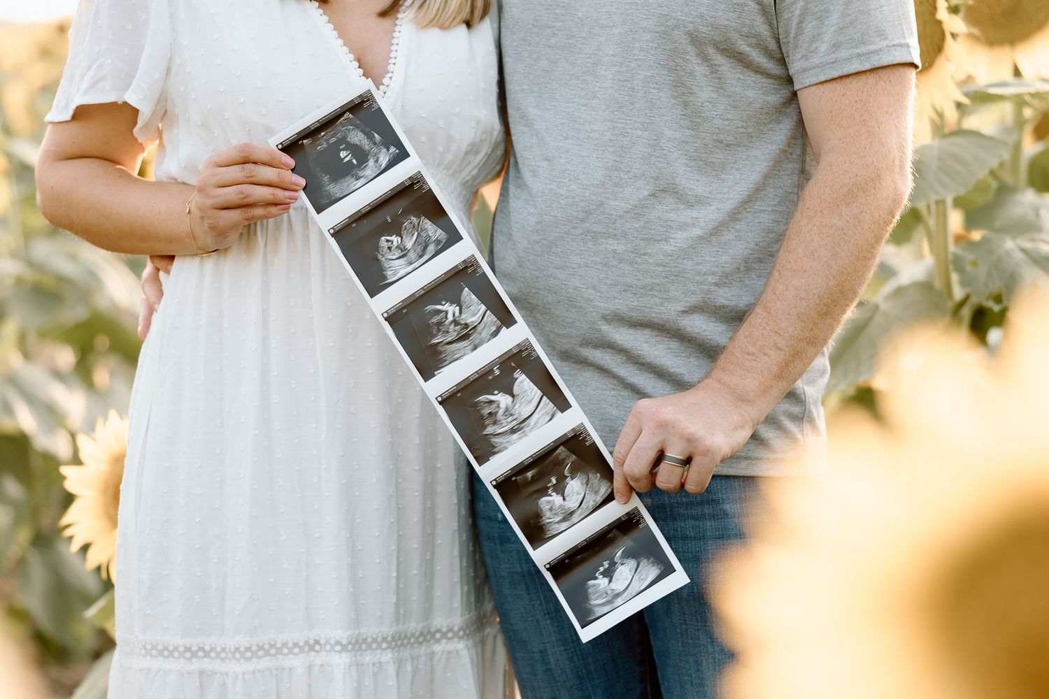 A couple in light colored clothing holds ultrasound photos in a sunlit outdoor setting with sunflowers.