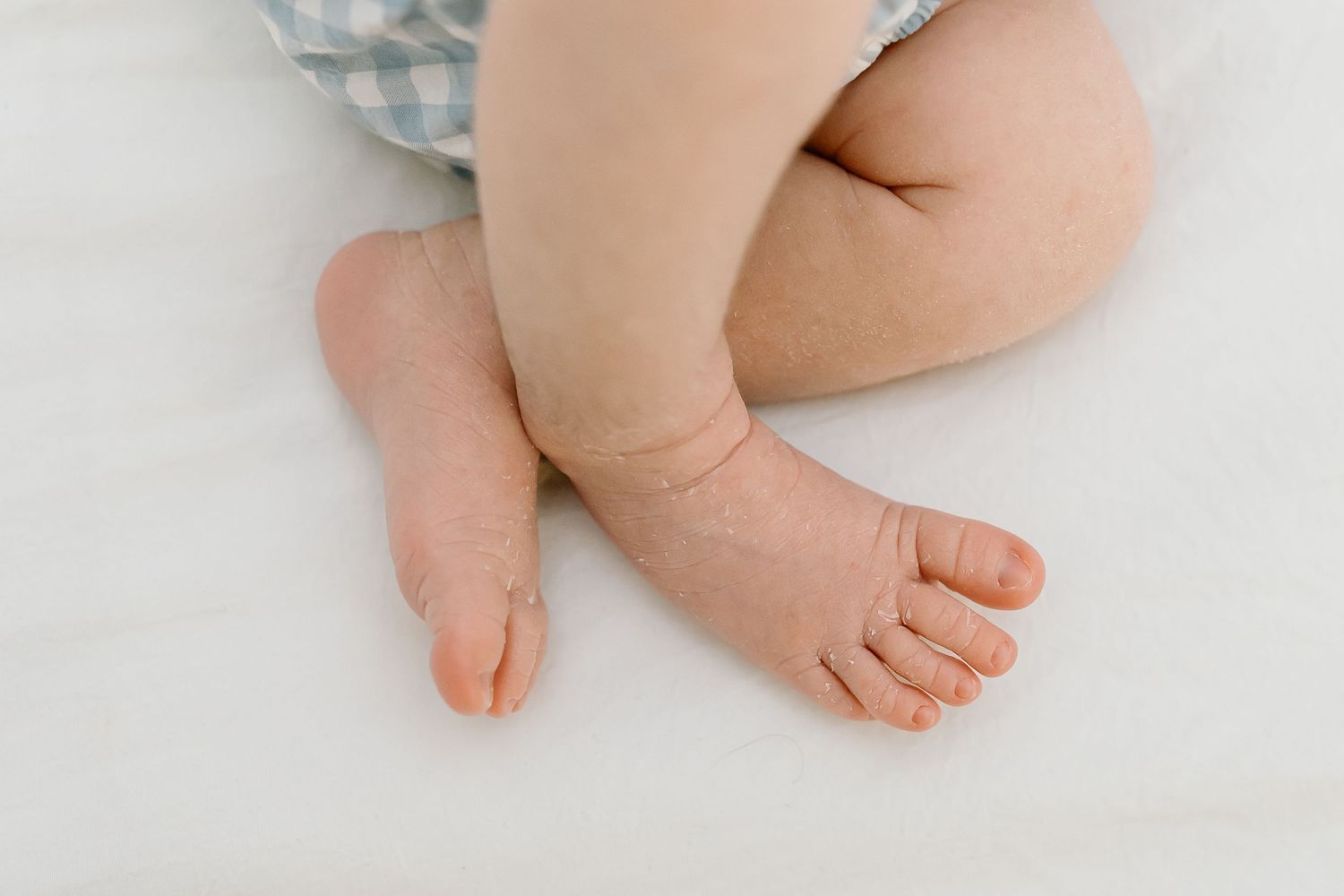 Close up view of tiny baby feet and legs resting on white bedding.