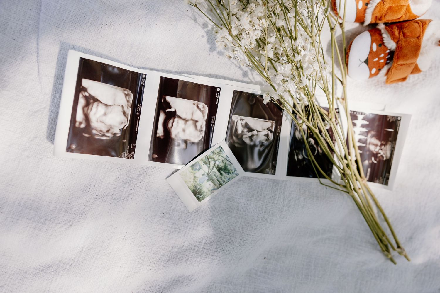 Collection of ultrasound photos arranged artistically on white surface.
