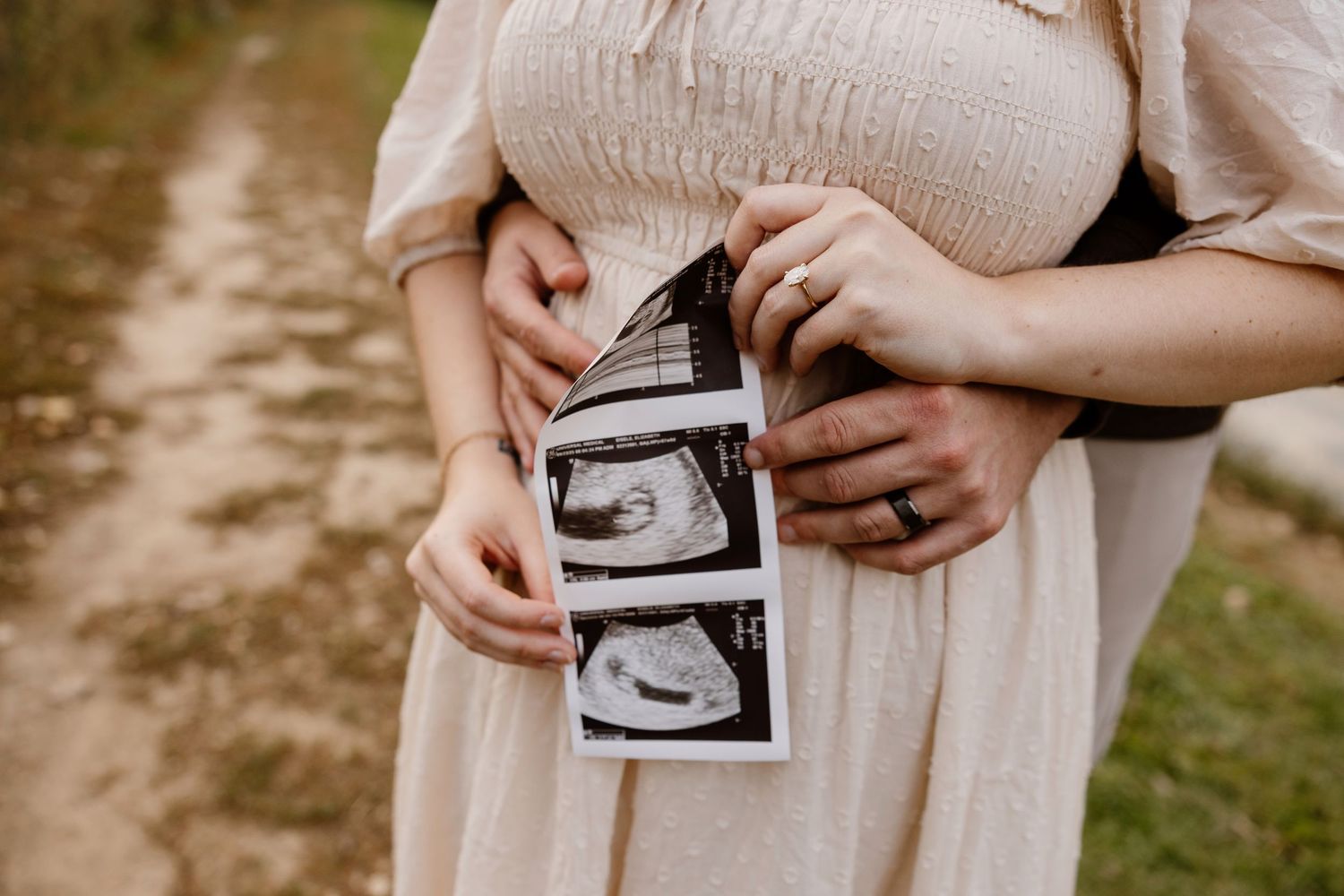 Close-up shots of hands holding ultrasound photos on a sunny outdoor day.