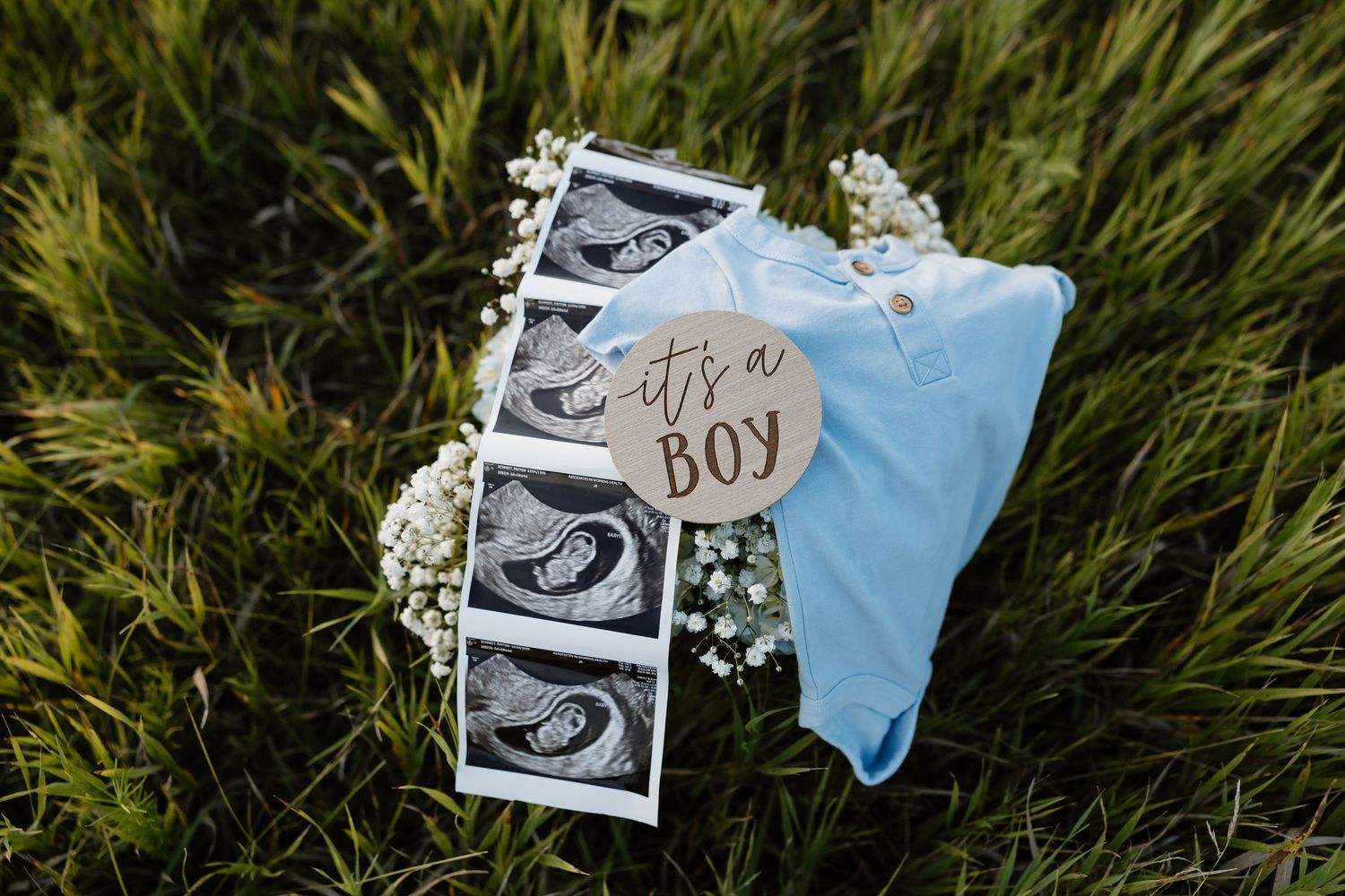 Ultrasound photos and baby announcement items arranged on green grass.