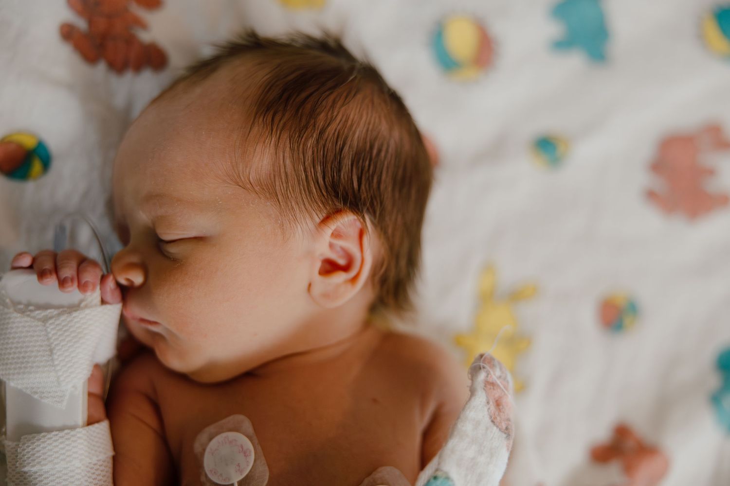 Close-up view of sleeping newborn with medical monitoring sensors.