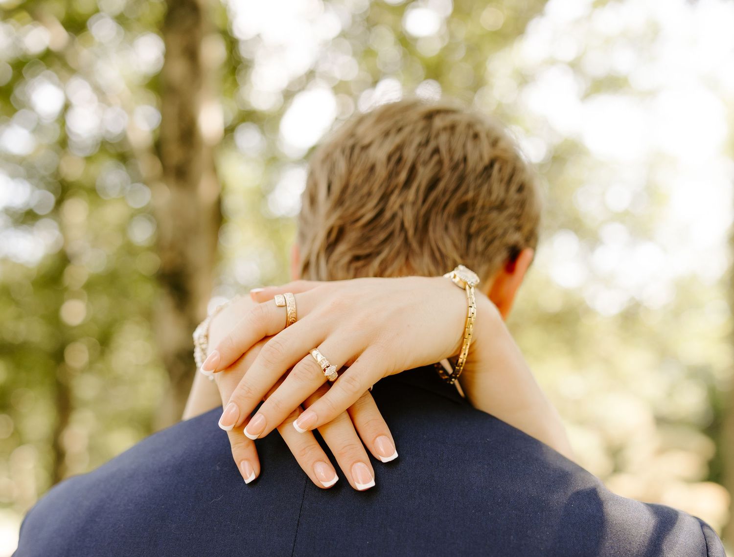 Tender embrace captured in a sun-dappled forest setting.