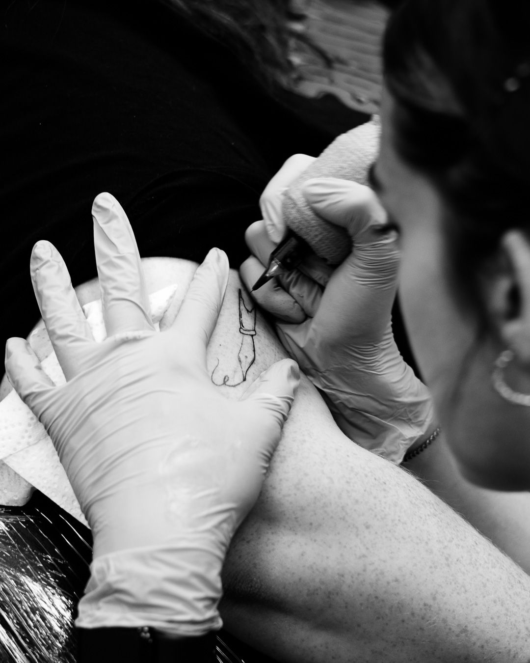 Medical professional in white gloves administers a dental injection to patient in black and white photograph.